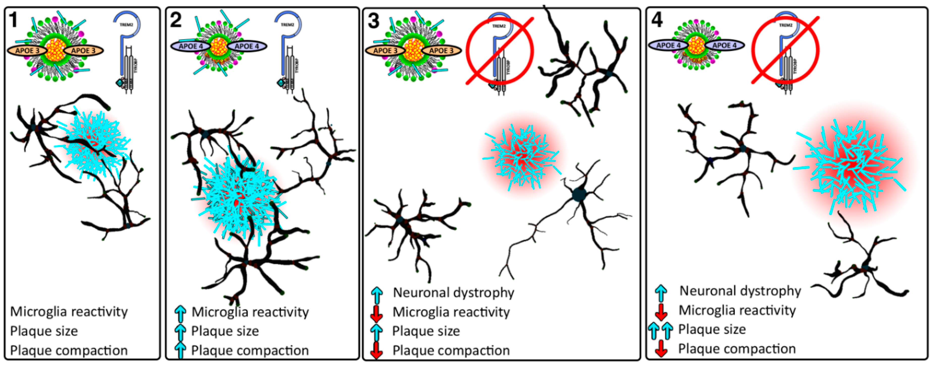 Beta Amyloid Plaques >> IJMS | Free Full-Text | The Role of APOE and TREM2 in Alzheimer′s Disease—Current Understanding ... Beta Amyloid Plaques >> IJMS | Free Full-Text | The Role of APOE and TREM2 in Alzheimer′s Disease—Current Understanding ...
