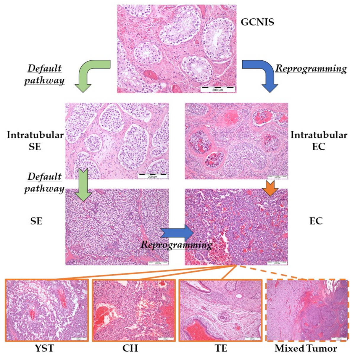 IJMS | Free Full-Text | Human Germ Cell Tumors are Developmental ...