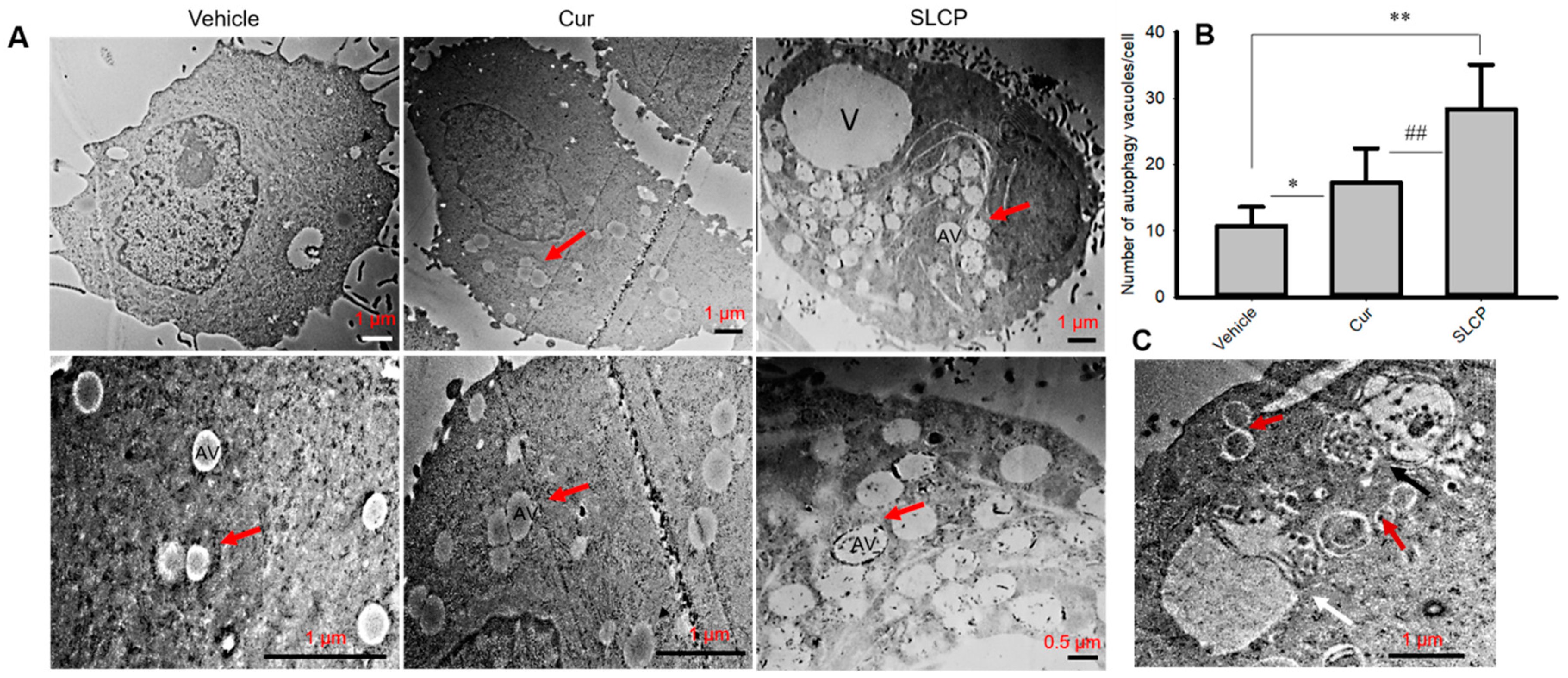 Combination treatment of berberine and solid lipid curcumin particles  increased cell death and inhibited PI3K/Akt/mTOR pathway of human cultured  glioblastoma cells more effectively than did individual treatments