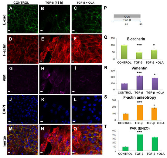 Ijms Free Full Text Parp 1 2 Inhibitor Olaparib Prevents Or Partially Reverts Emt Induced By Tgf B In Nmumg Cells Html