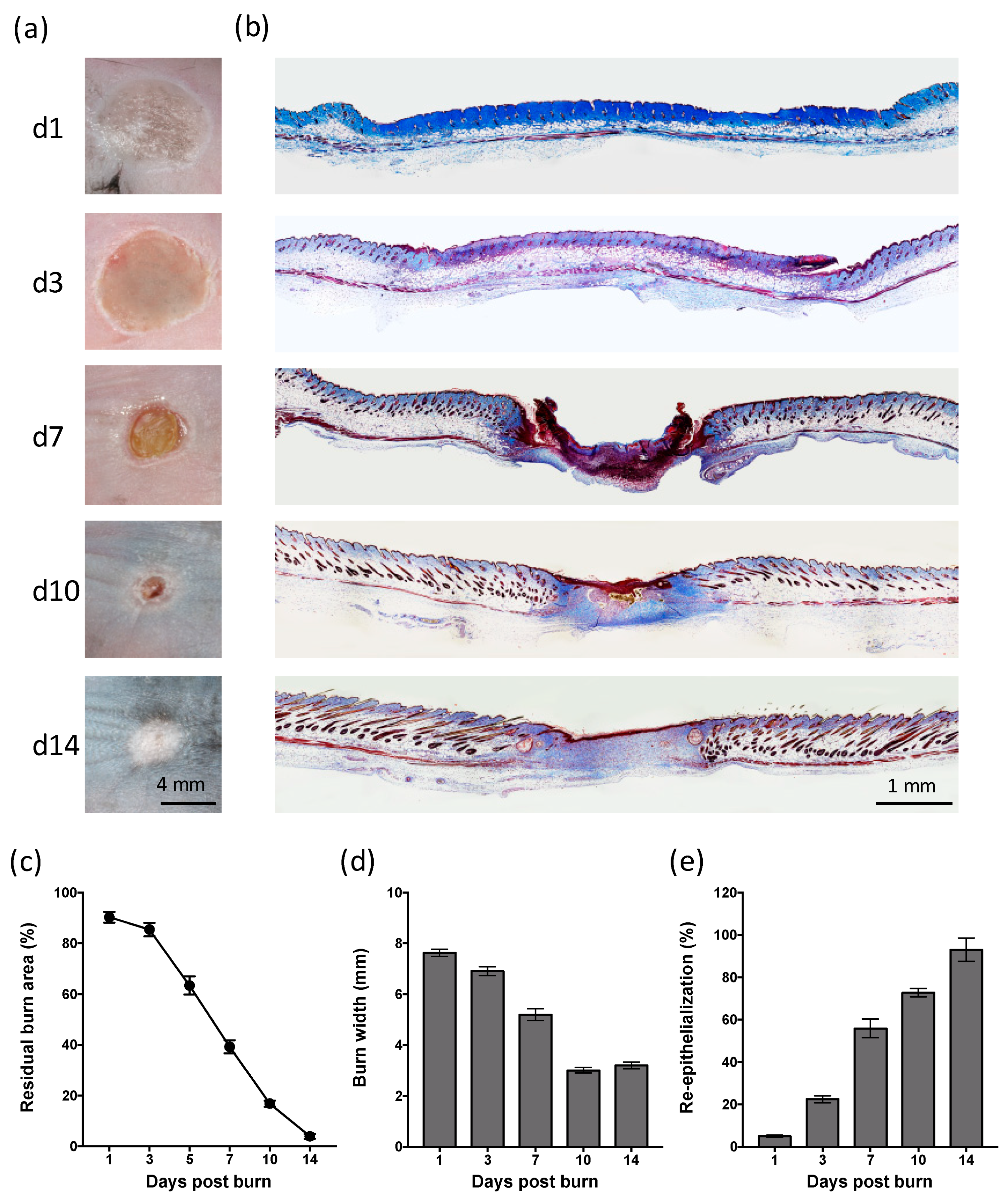 ijms free full text the cutaneous inflammatory response to thermal injury