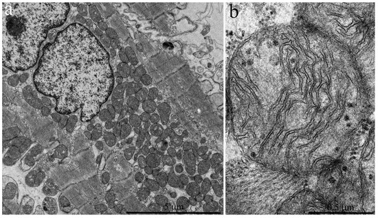 Delayed Onset of Age-Dependent Changes in Ultrastructure of Myocardial ...
