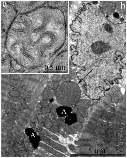Delayed Onset of Age-Dependent Changes in Ultrastructure of Myocardial ...