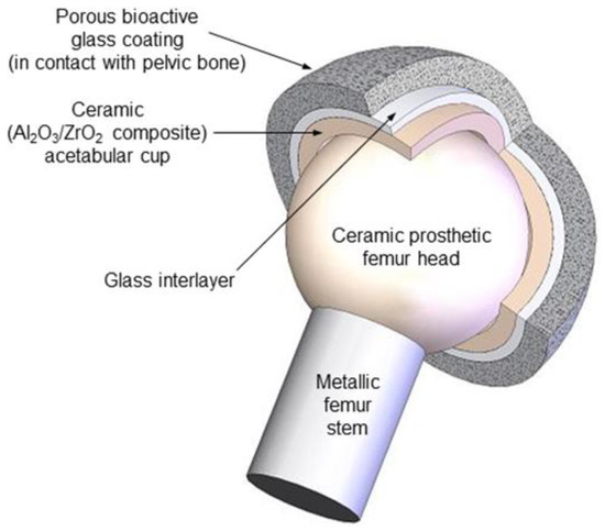IJMS | Free Full-Text | In Vitro Assessment Of Bioactive Glass.