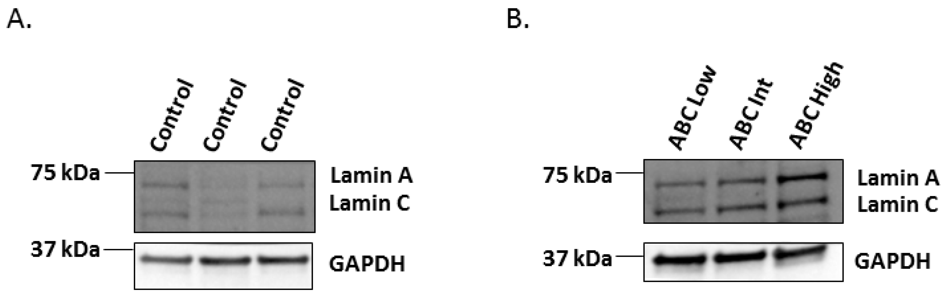 Lamin B2 Follows Lamin A C Mediated Nuclear Mechanics And Cancer Cell Invasion Efficacy Biorxiv