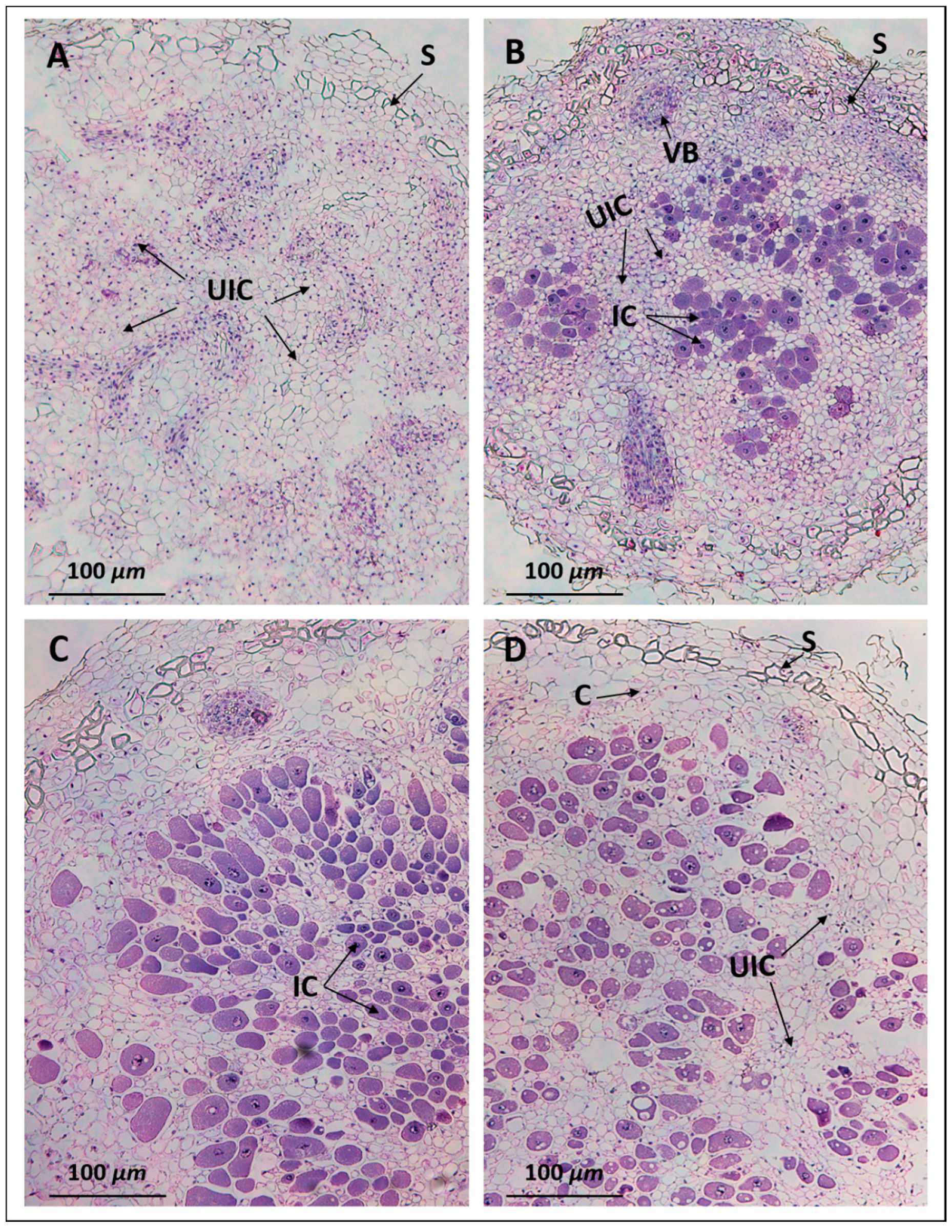 Ijms 20 01091 g004