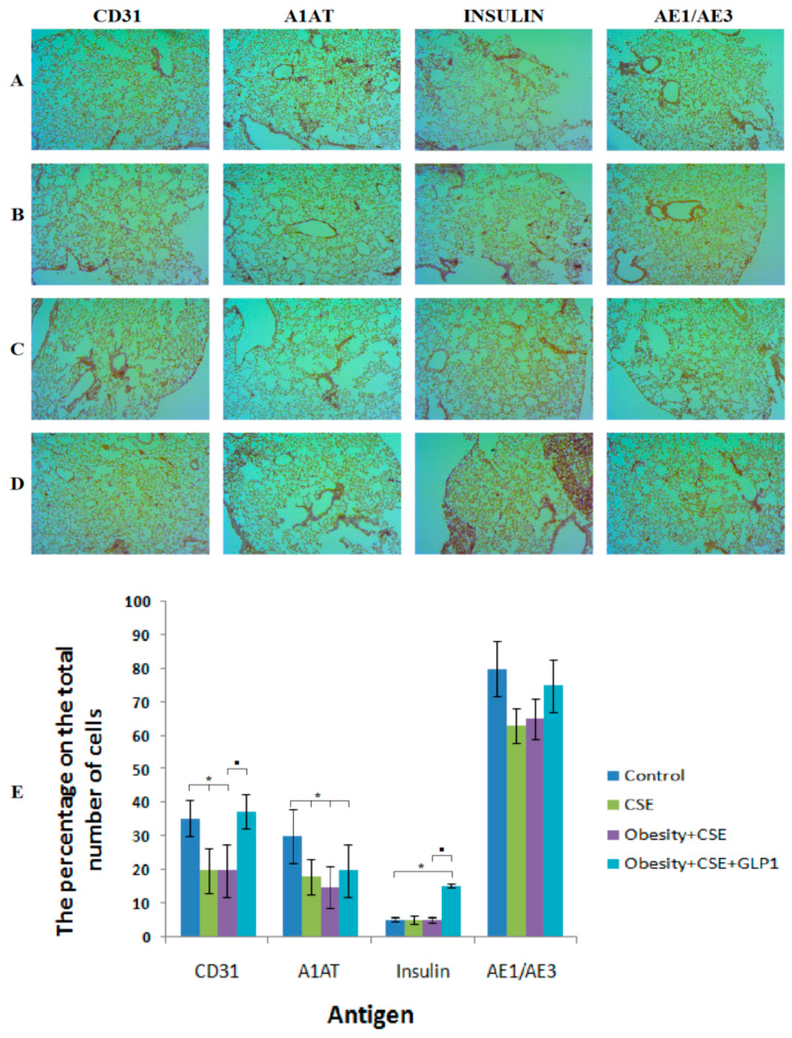 Endothelial Progenitor Cells as Pathogenetic and Diagnostic