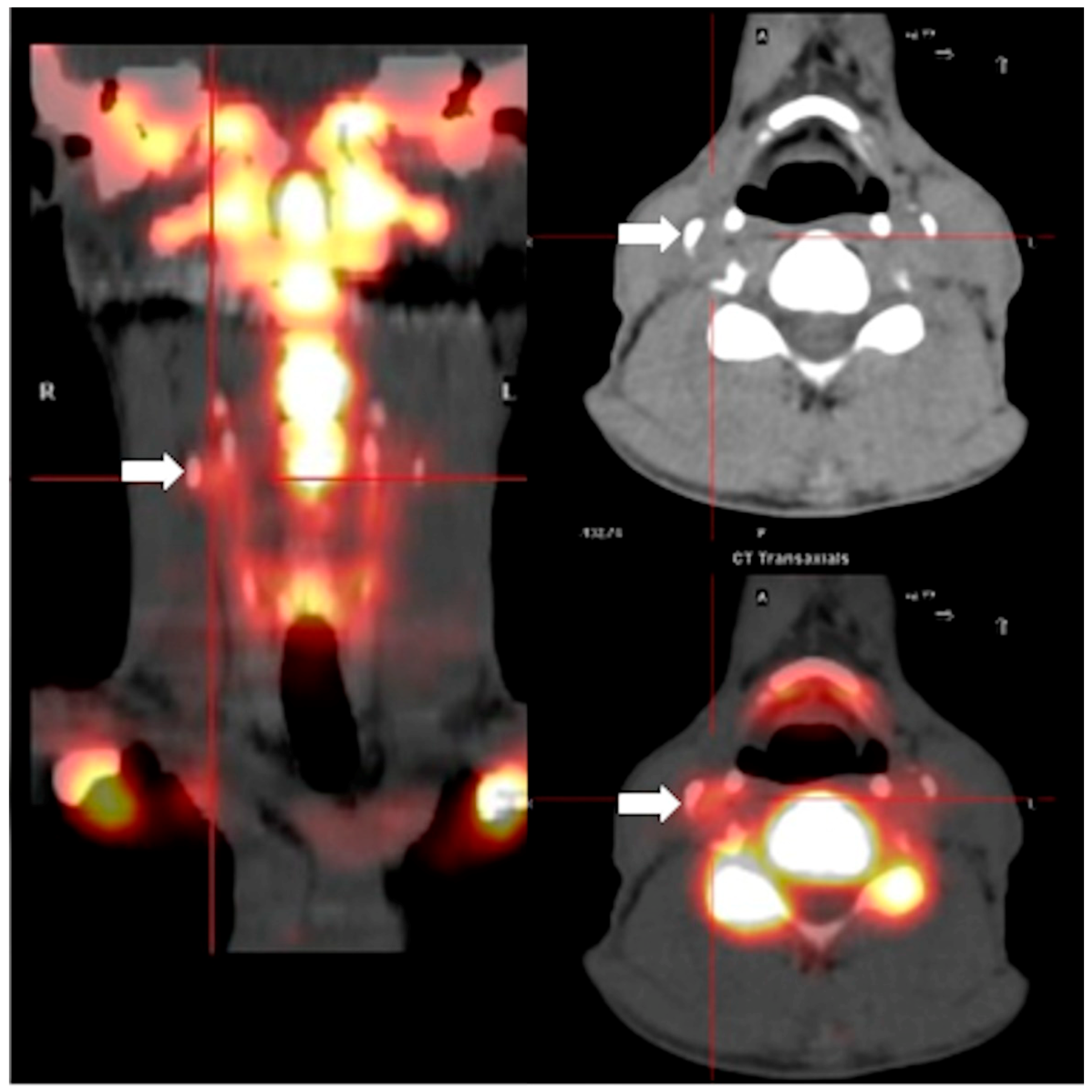 Ijms 20 01183 g001 Ijms 20 01183 g001