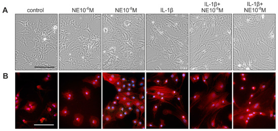 Ijms Free Fulltext Cell Death In Chondrocytes