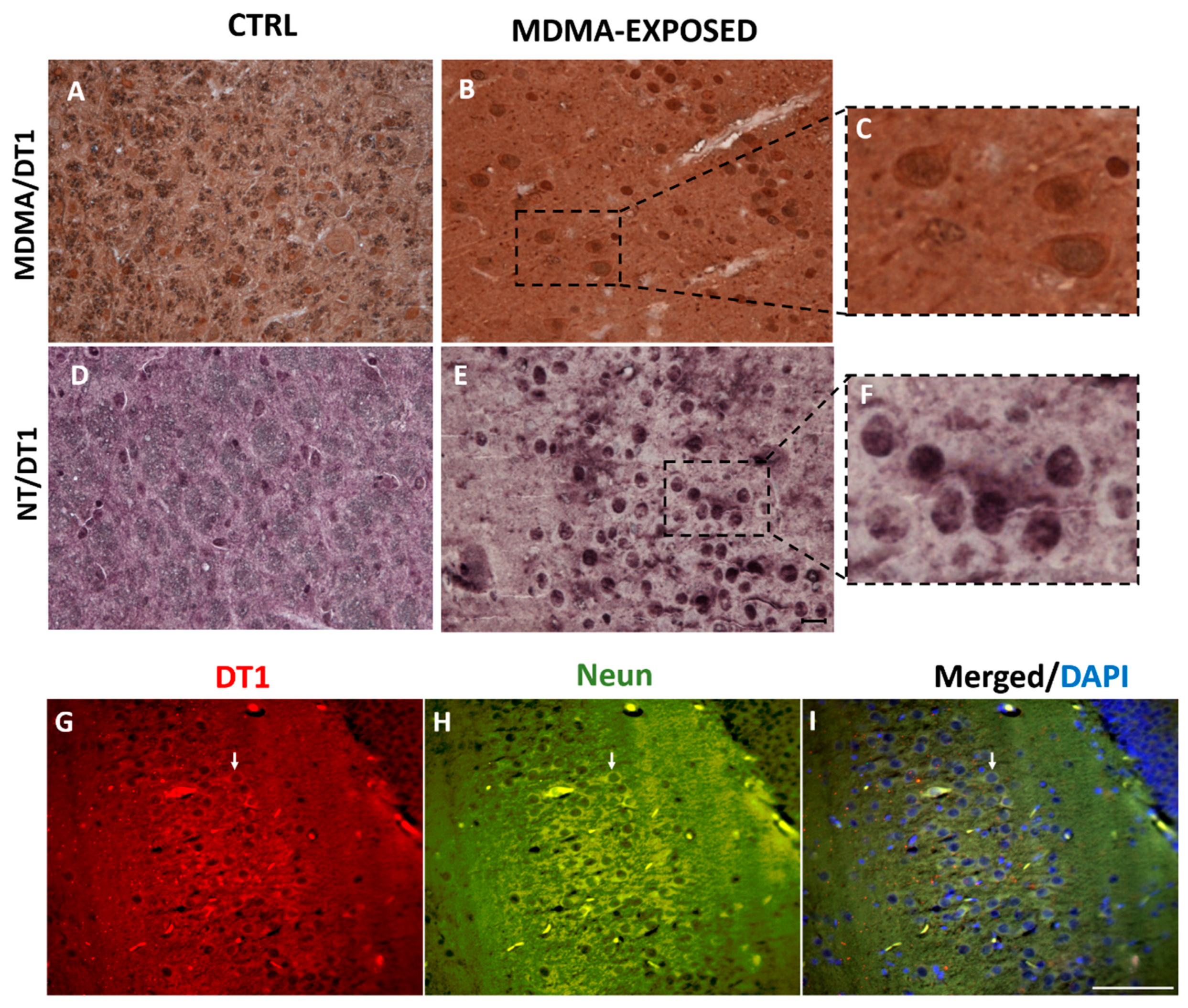 Ijms 20 01242 g004 Ijms 20 01242 g004