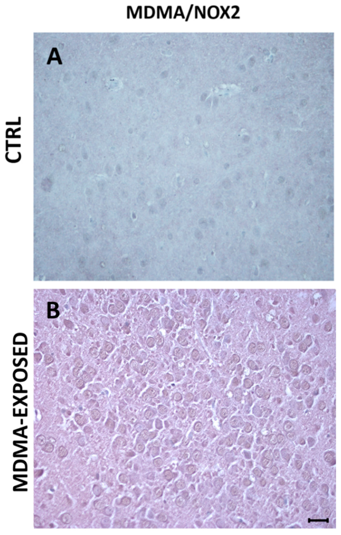 Ijms 20 01242 g007 Ijms 20 01242 g007