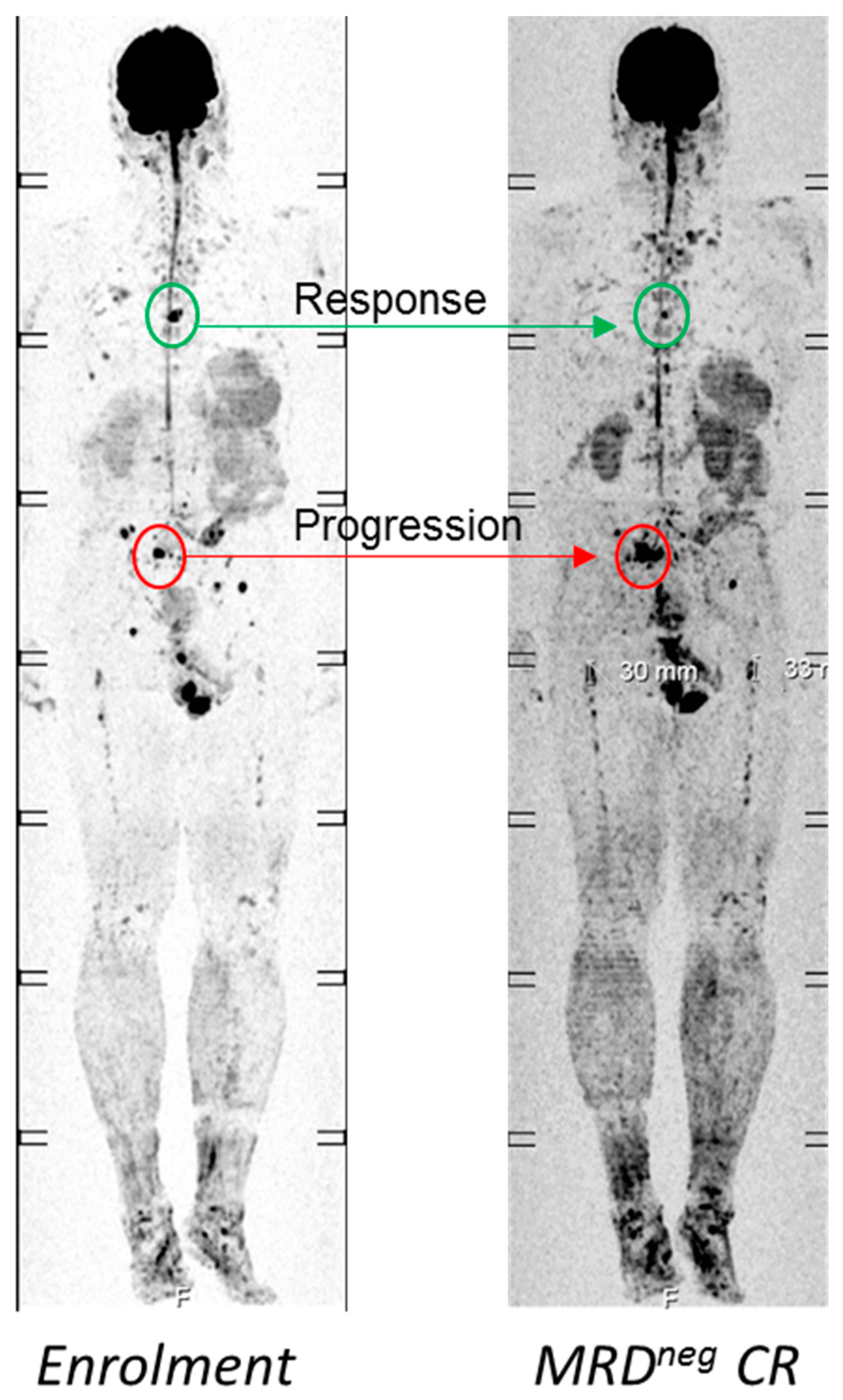Ijms 20 01248 g003 Ijms 20 01248 g003