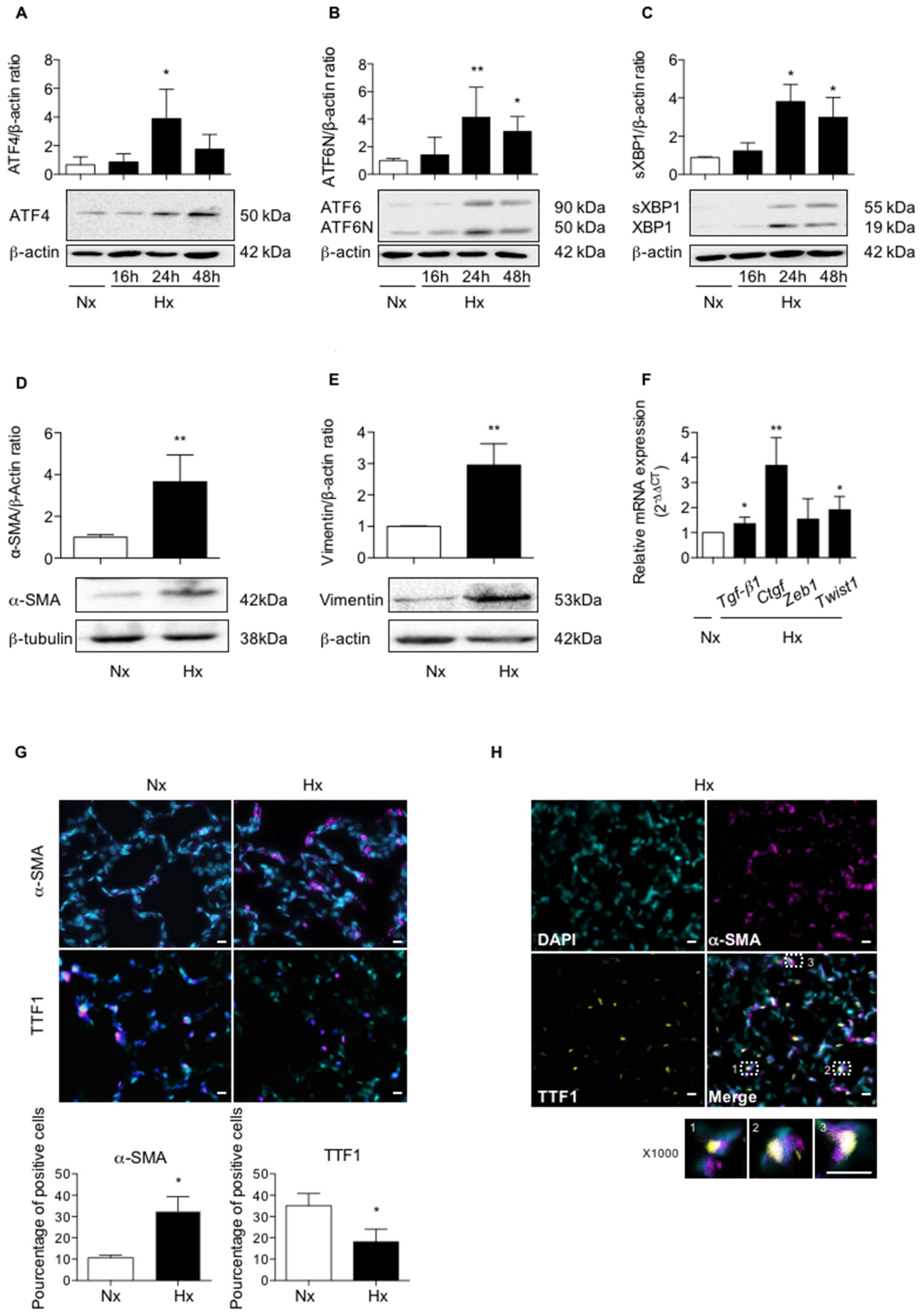 Ijms 20 01299 g001 550