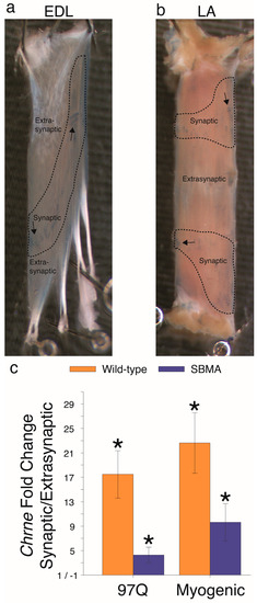 IJMS Special Issue Brain Derived Neurotrophic Factor 2018