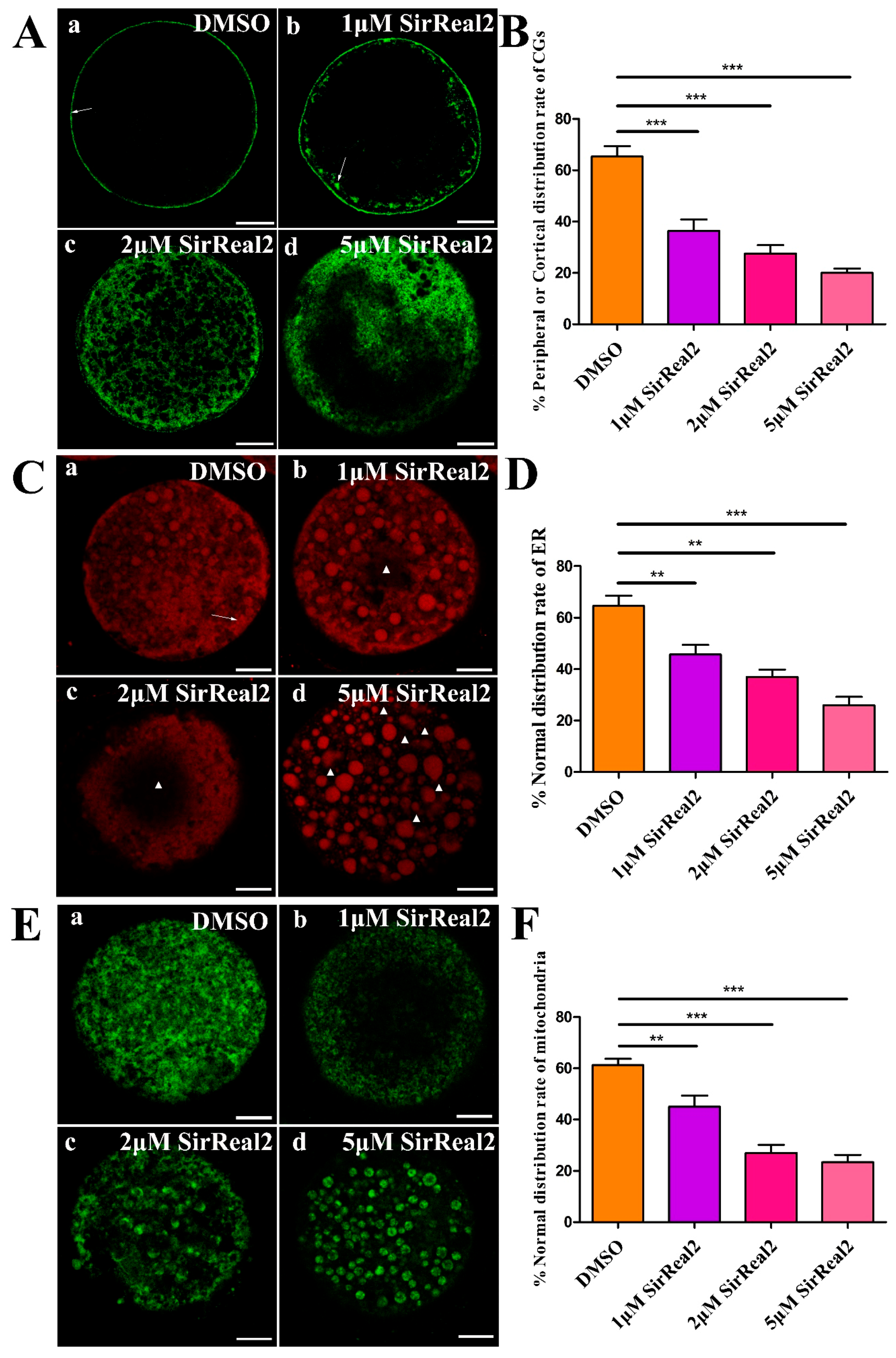 Ijms 20 01365 g004 Ijms 20 01365 g004