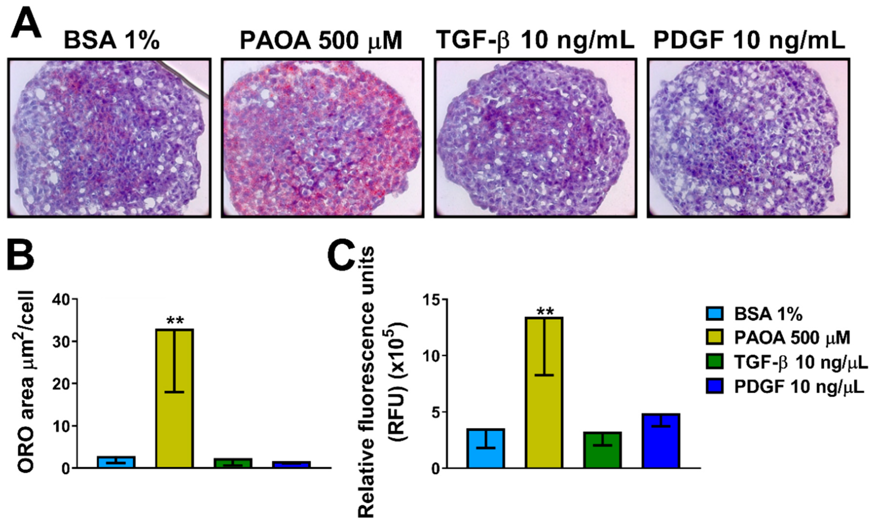 Ijms Free Full Text Human Multilineage 3d Spheroids As A Model Of Liver Steatosis And Fibrosis Html