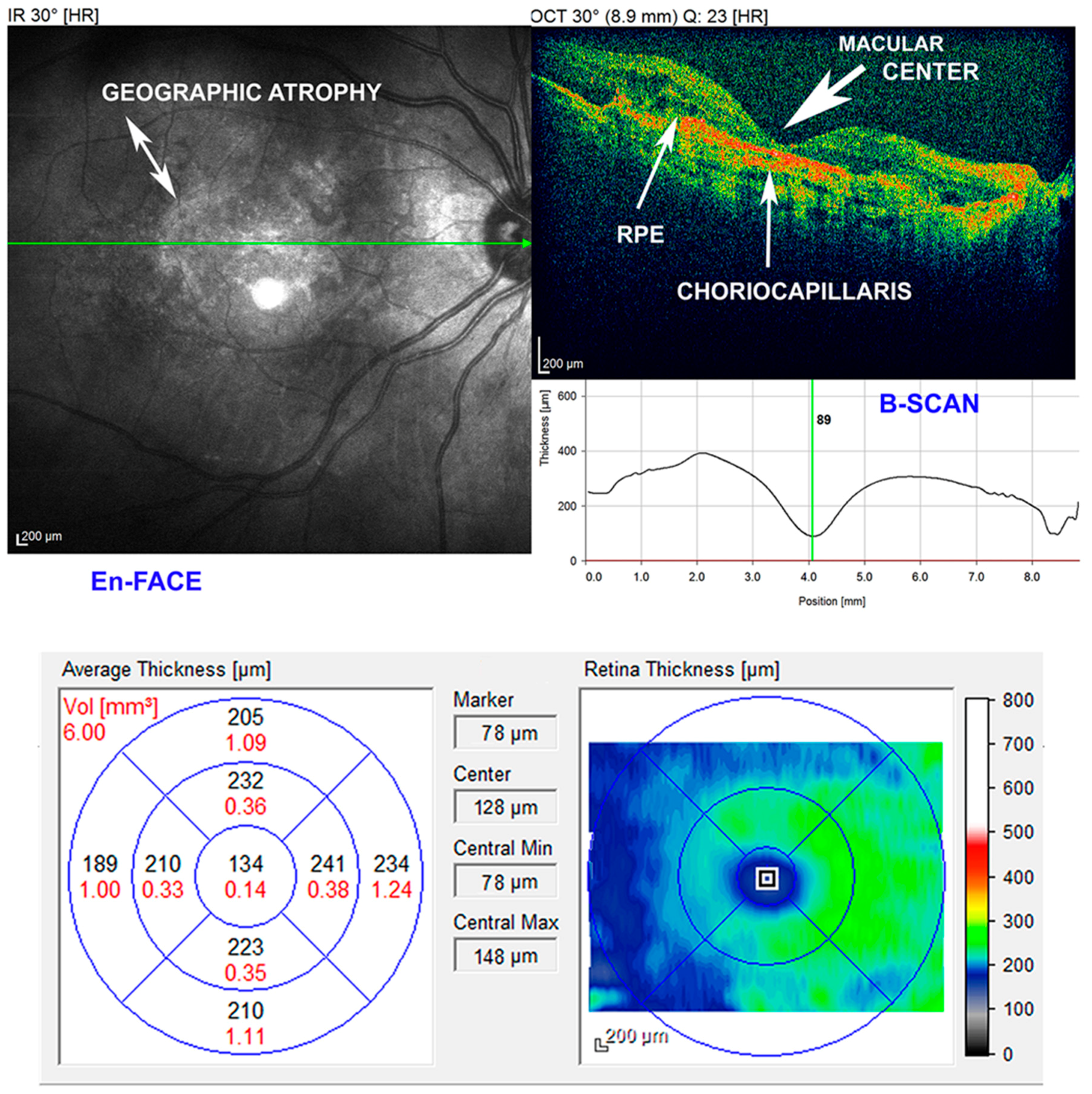 Ijms 20 01693 g001 550