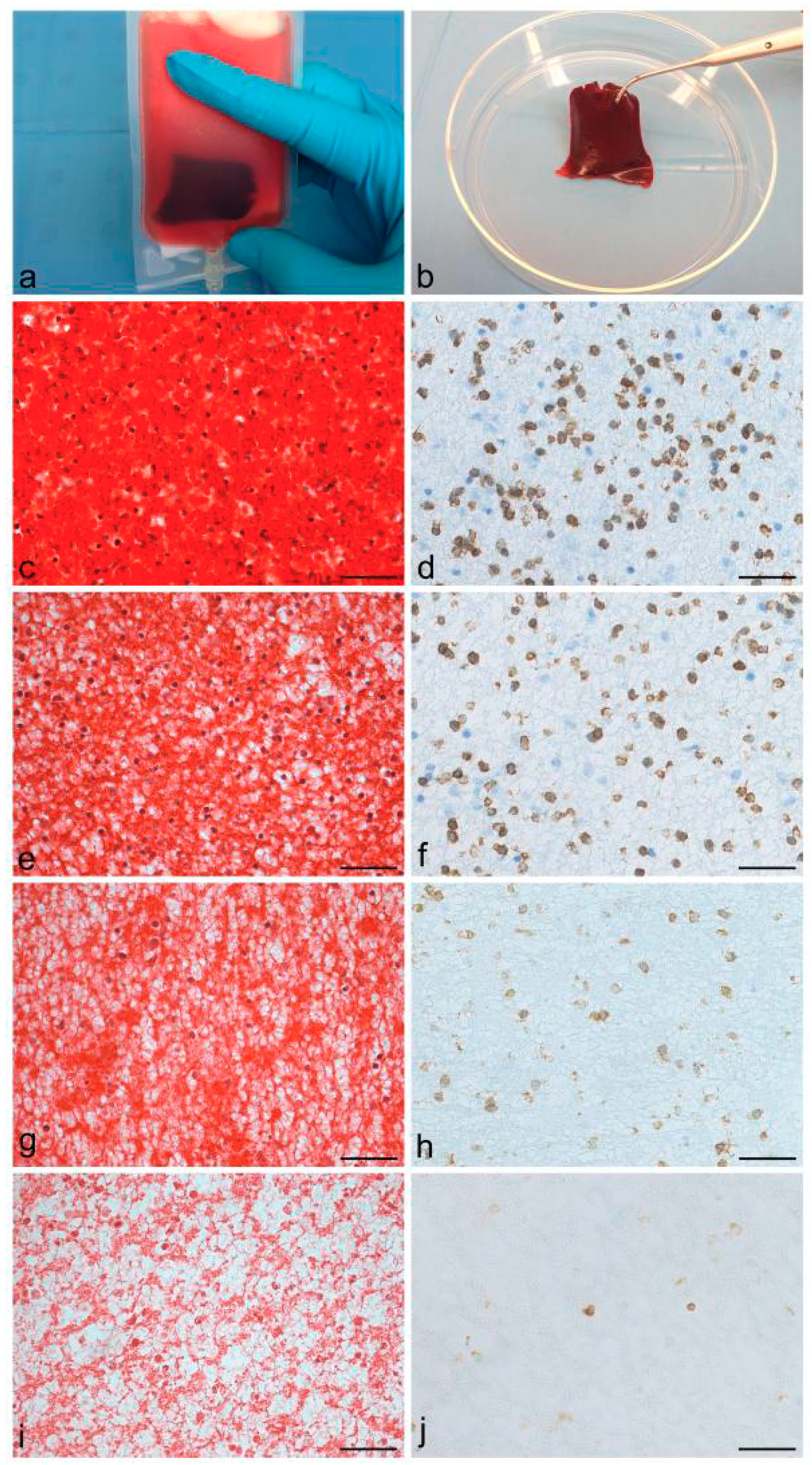 Ijms Free Full Text Platelet Rich Fibrin Scaffolds For Cartilage And Tendon Regenerative Medicine From Bench To Bedside Html