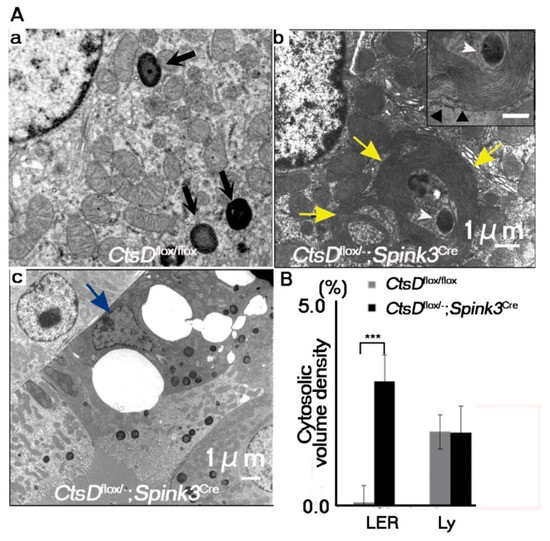 IJMS | Special Issue : Biogenesis and Functional Roles of Lysosomes