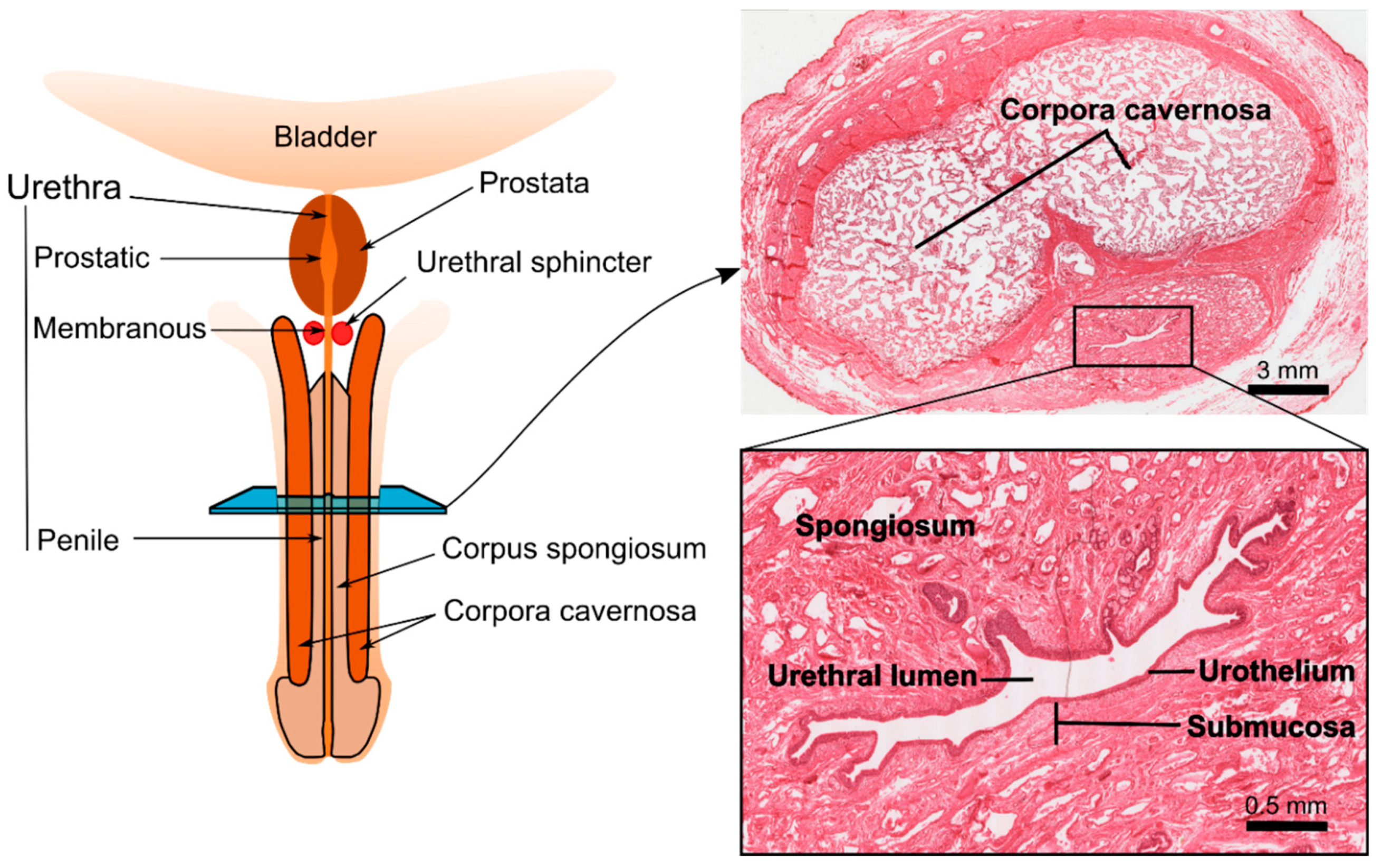 Prostatita neovir