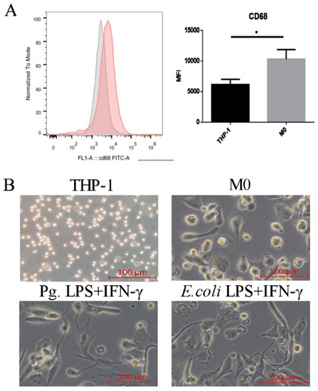 TET1 Knockdown Inhibits Porphyromonas gingivalis LPS/IFN-γ