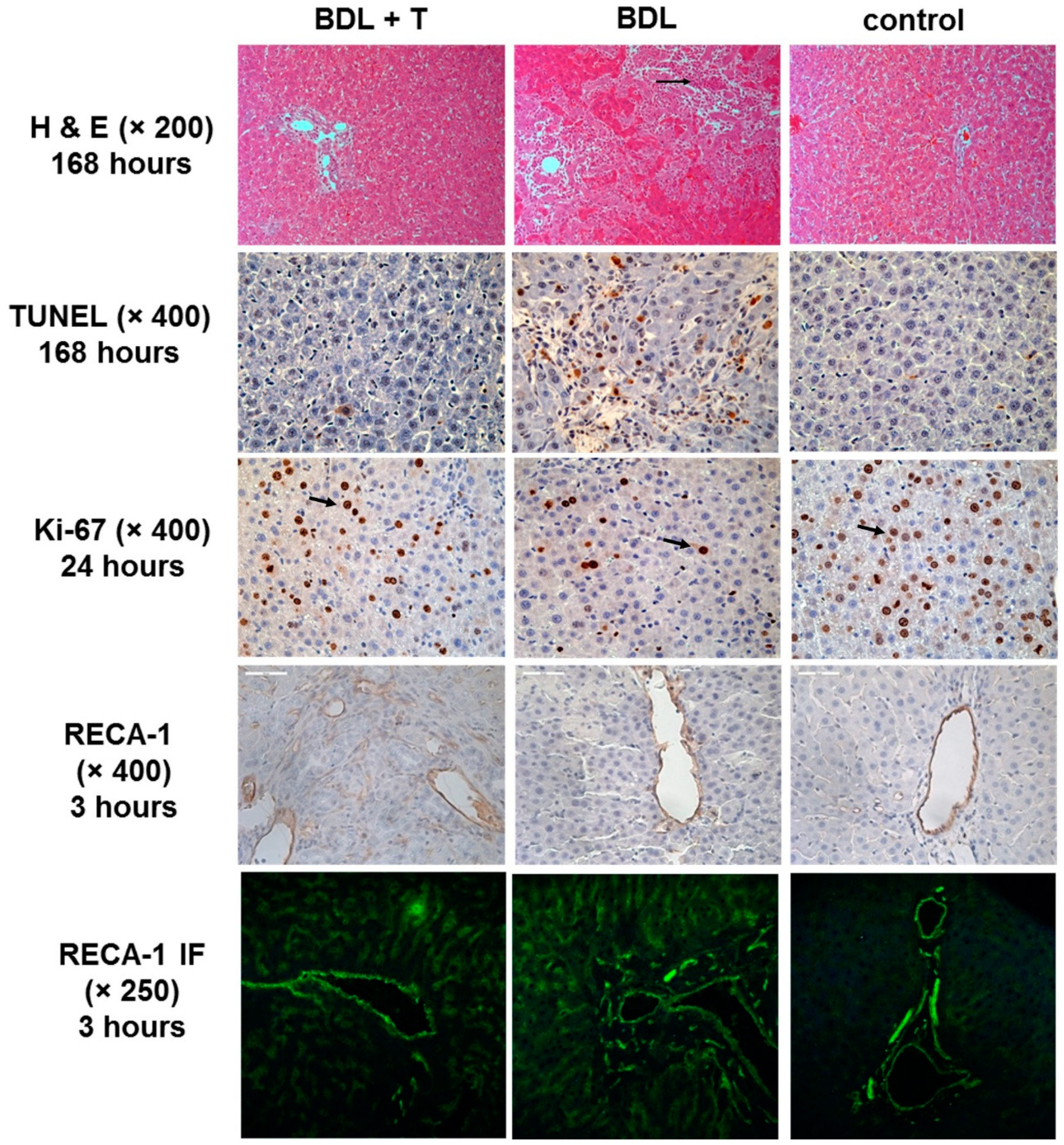 IJMS | Free Full-Text | The Impact of a Nitric Oxide Synthase Inhibitor  (L-NAME) on Ischemia–Reperfusion Injury of Cholestatic Livers by Pringle  Maneuver and Liver Resection after Bile Duct Ligation in Rats |