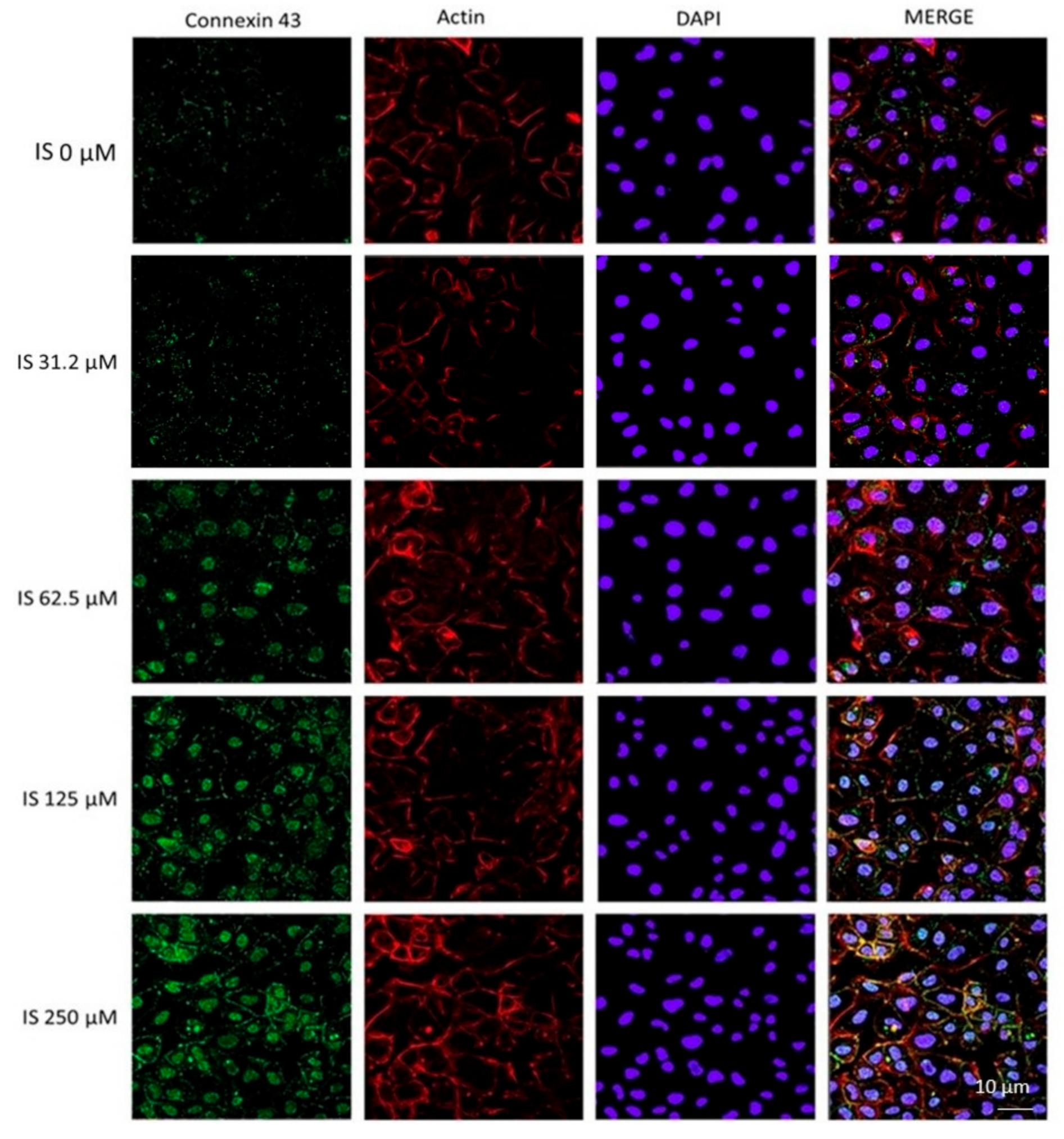 Ijms 20 02280 g005 Ijms 20 02280 g005