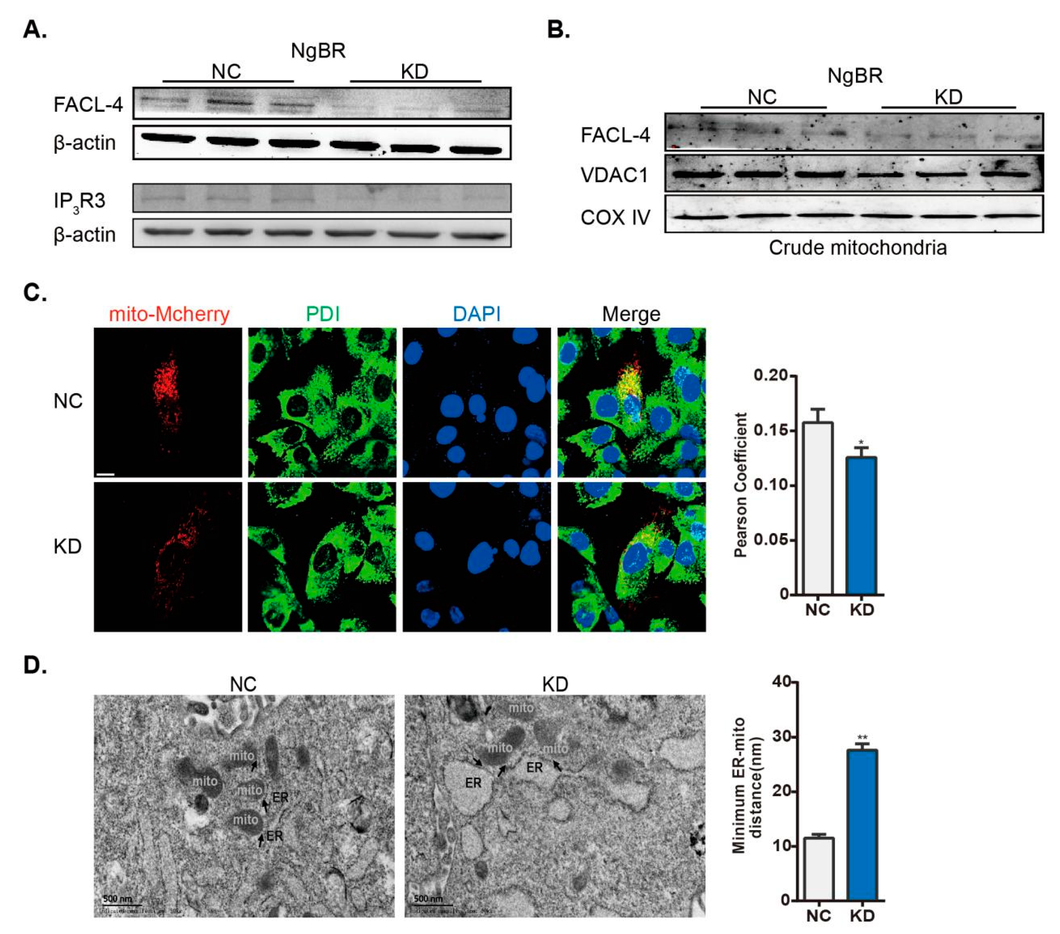 IJMS | Free Full-Text | Nogo-B Receptor Directs Mitochondria-Associated