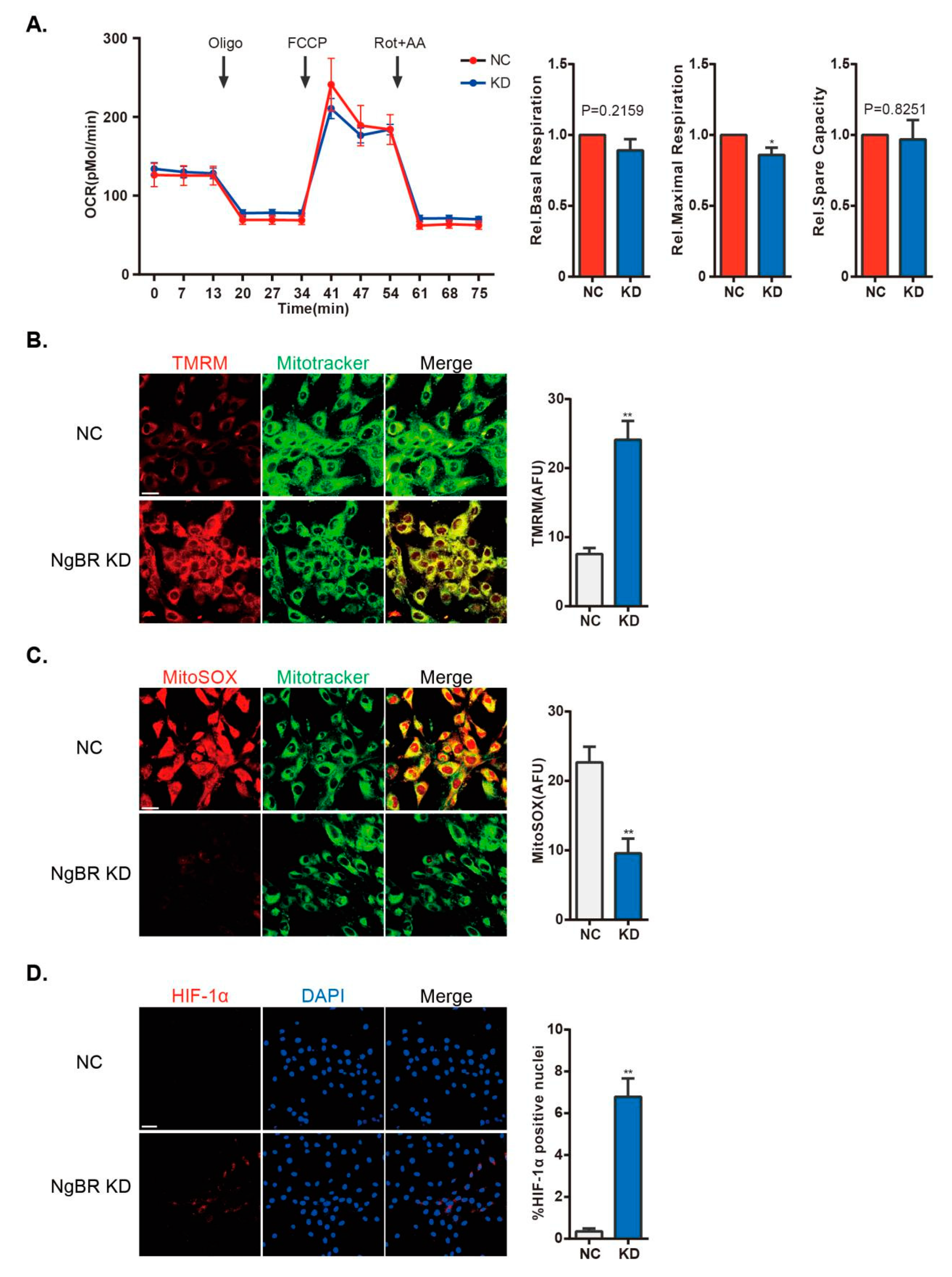 IJMS | Free Full-Text | Nogo-B Receptor Directs Mitochondria-Associated