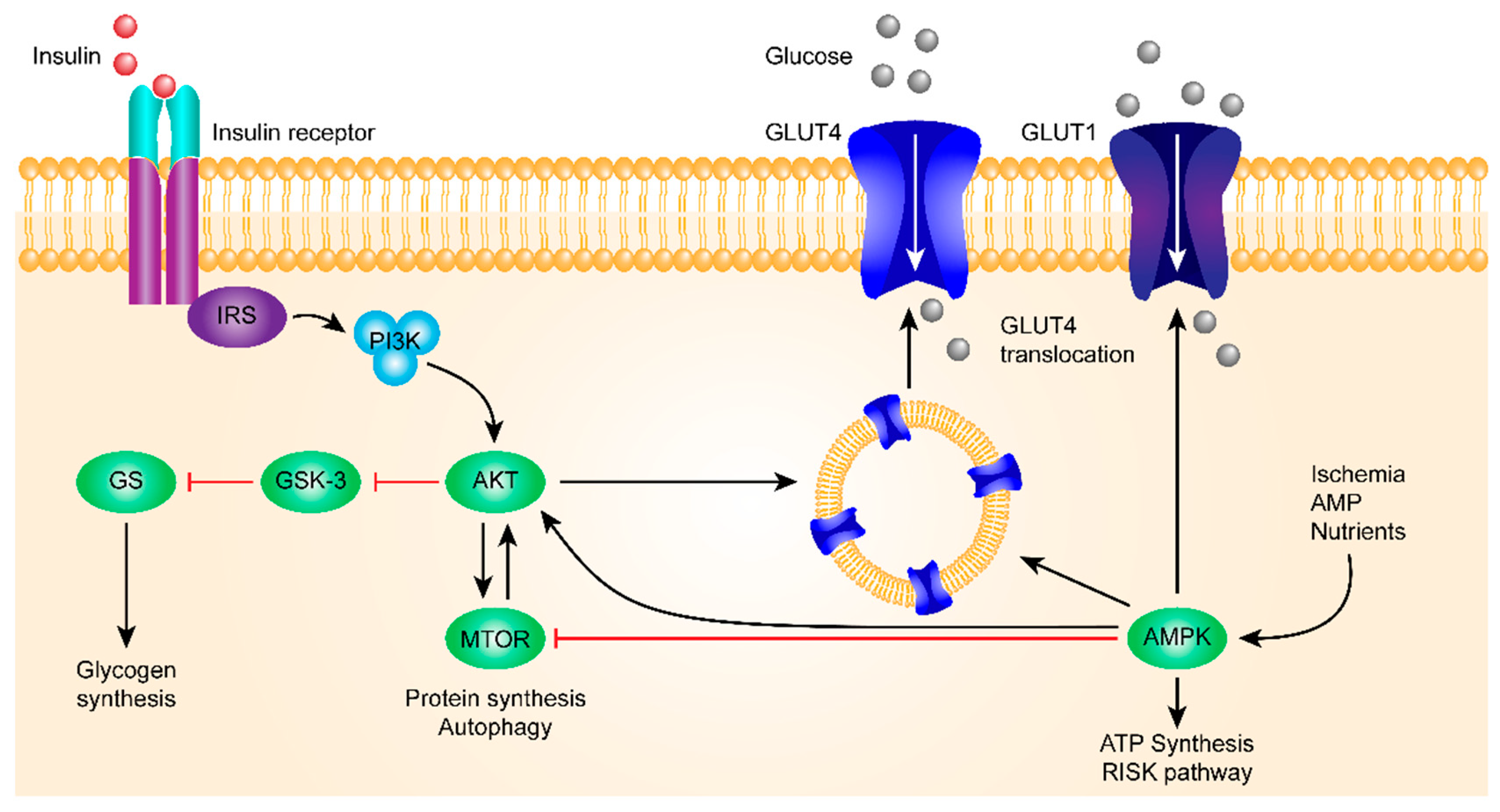 nice type 1 diabetes pathway