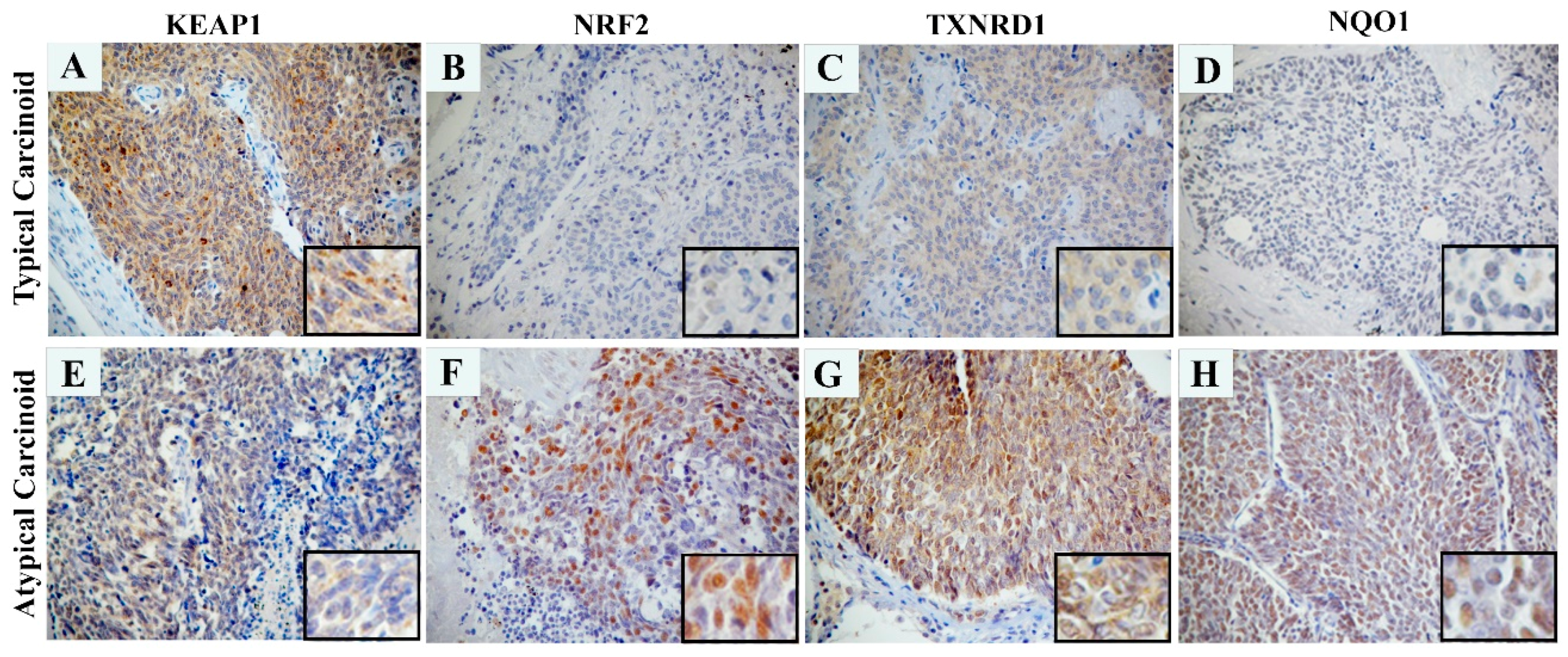 Ijms 20 02531 g004 Ijms 20 02531 g004