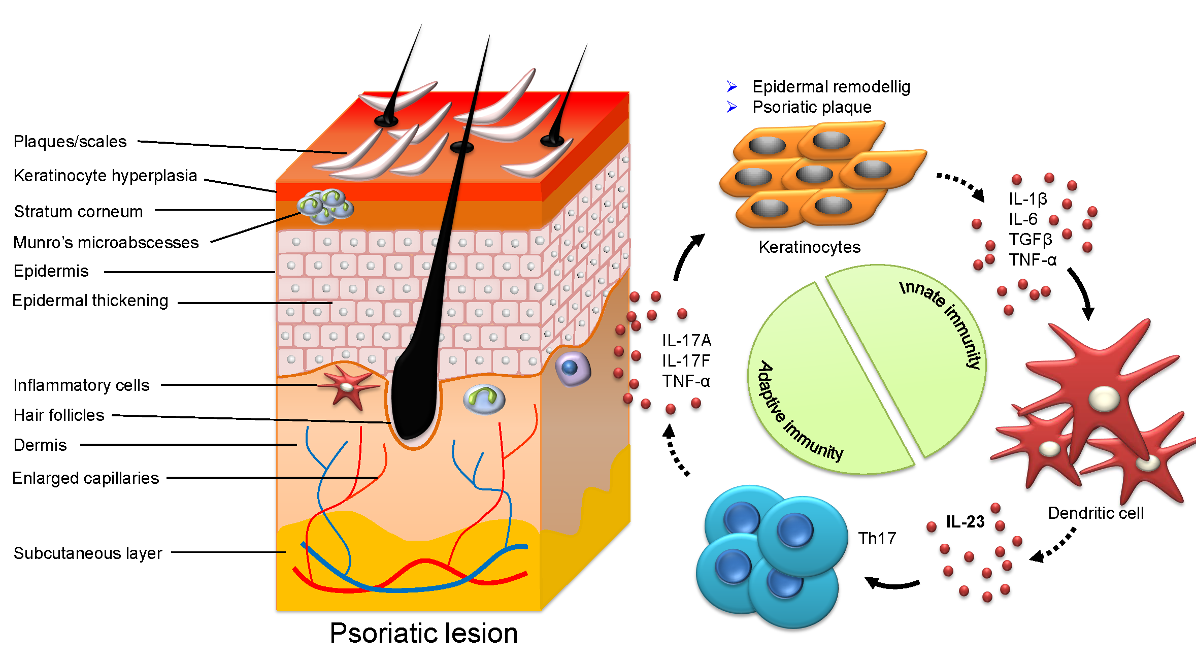 psoriasis triggers anti inflammatory)