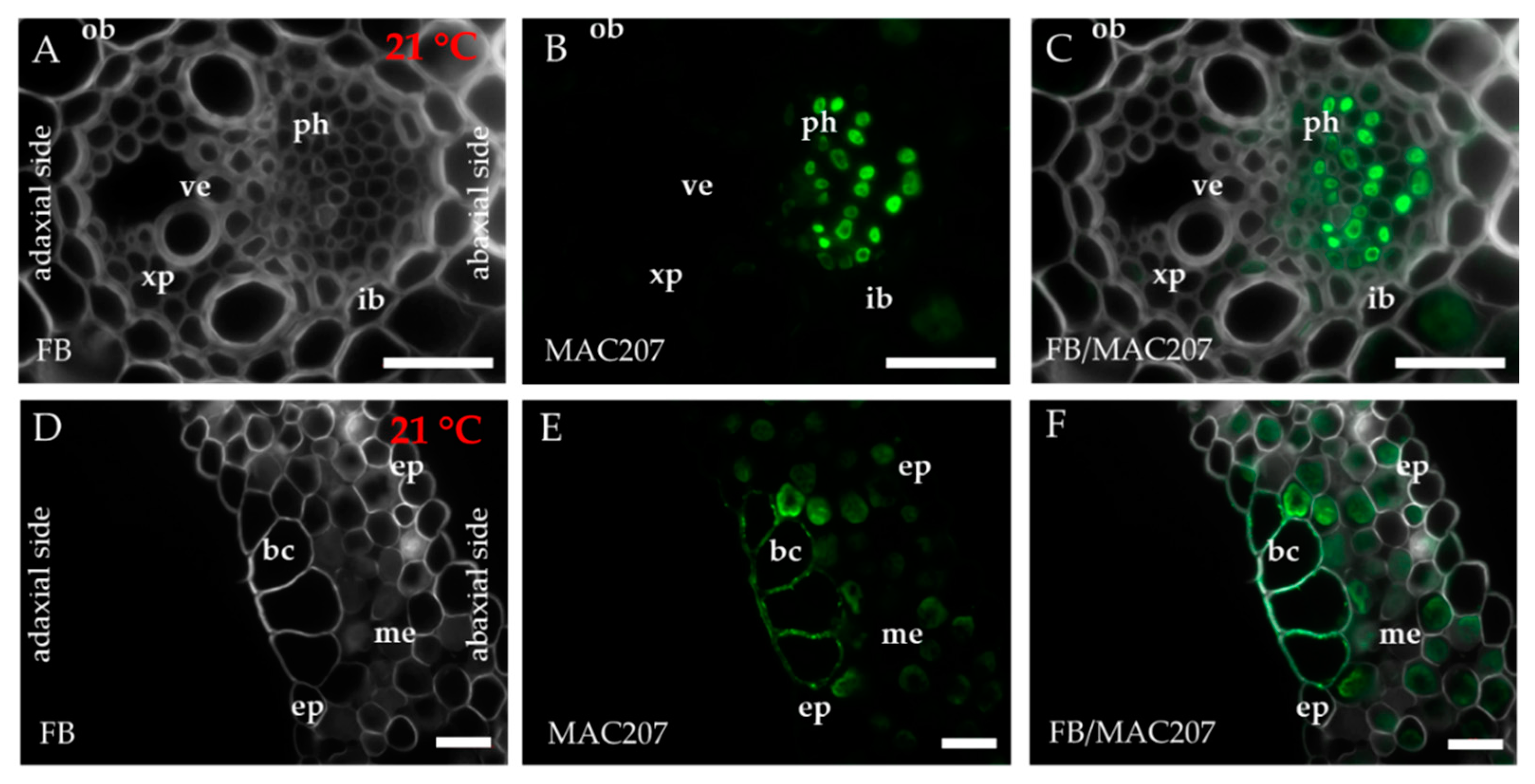 Ijms 20 02571 g0a3 Ijms 20 02571 g0a3