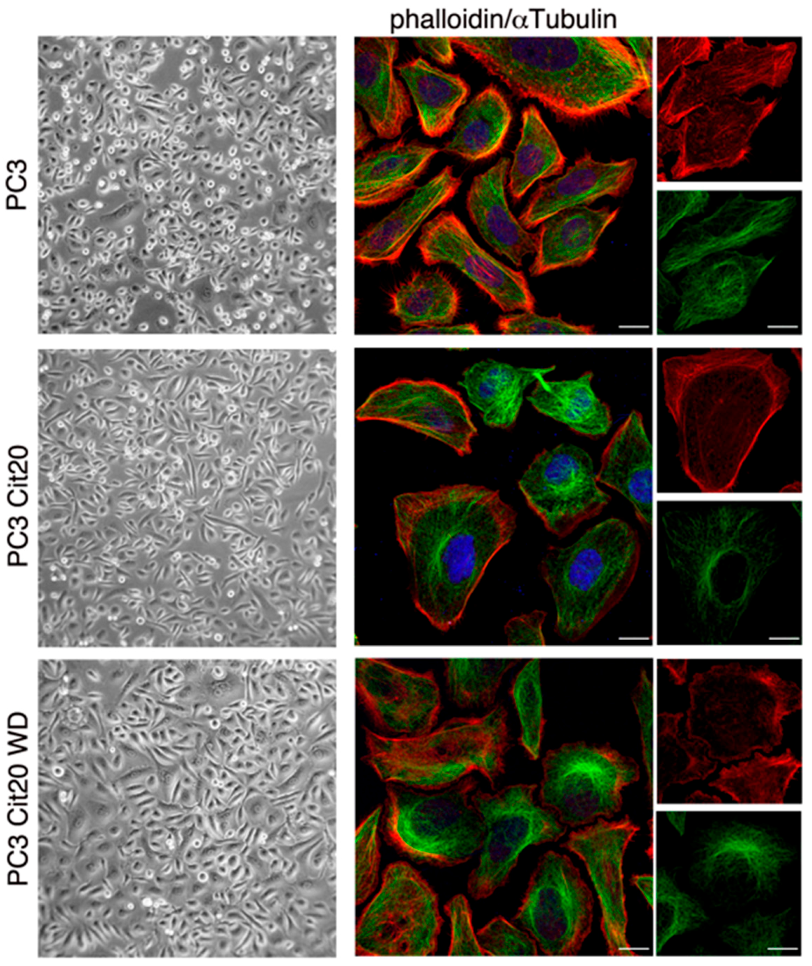 Effects of Long-Term Citrate Treatment in the PC3 Prostate