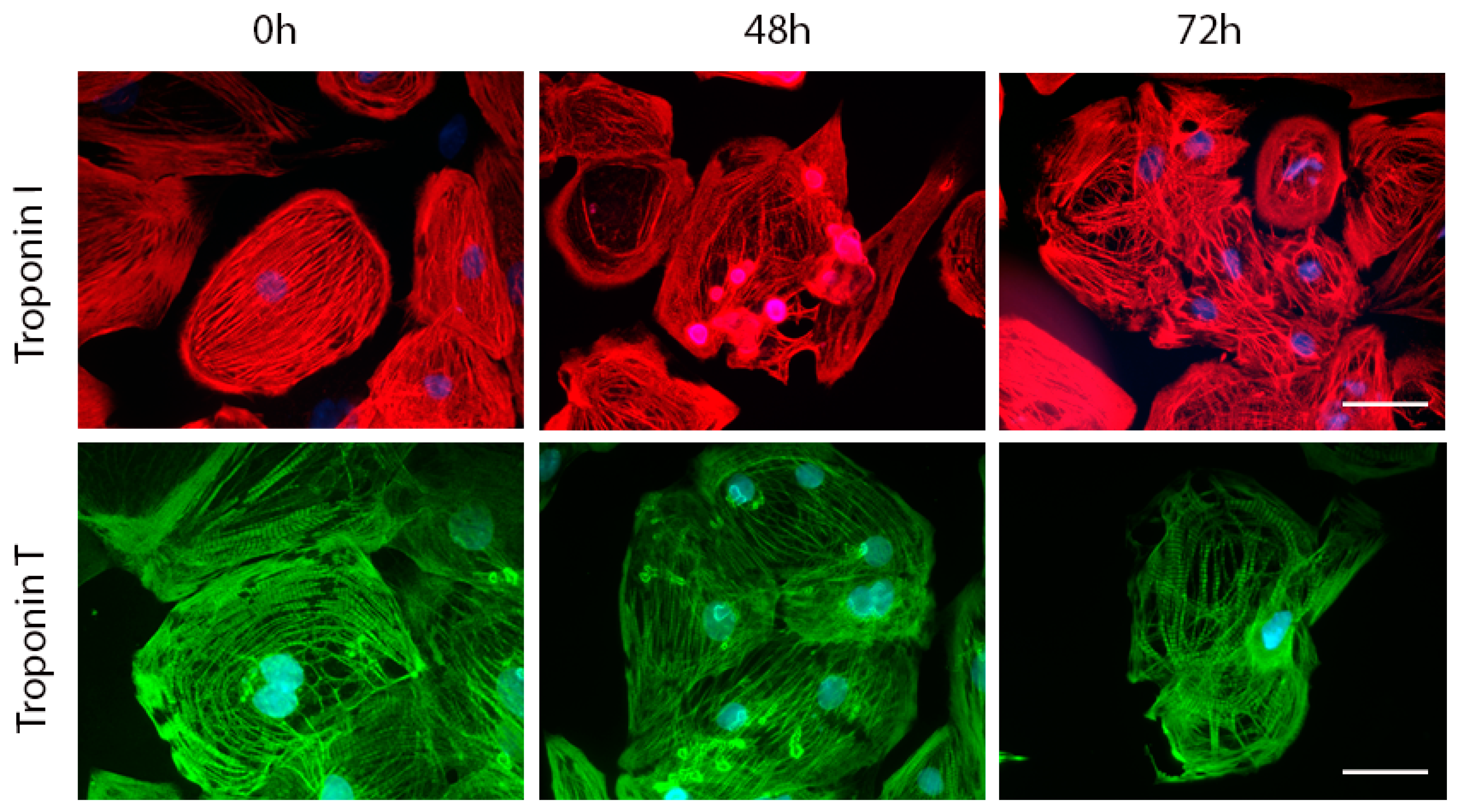 激安直営店 Cardiac Doxorubicin-Induced of Targets Among are Troponins ネックレス・ペンダント