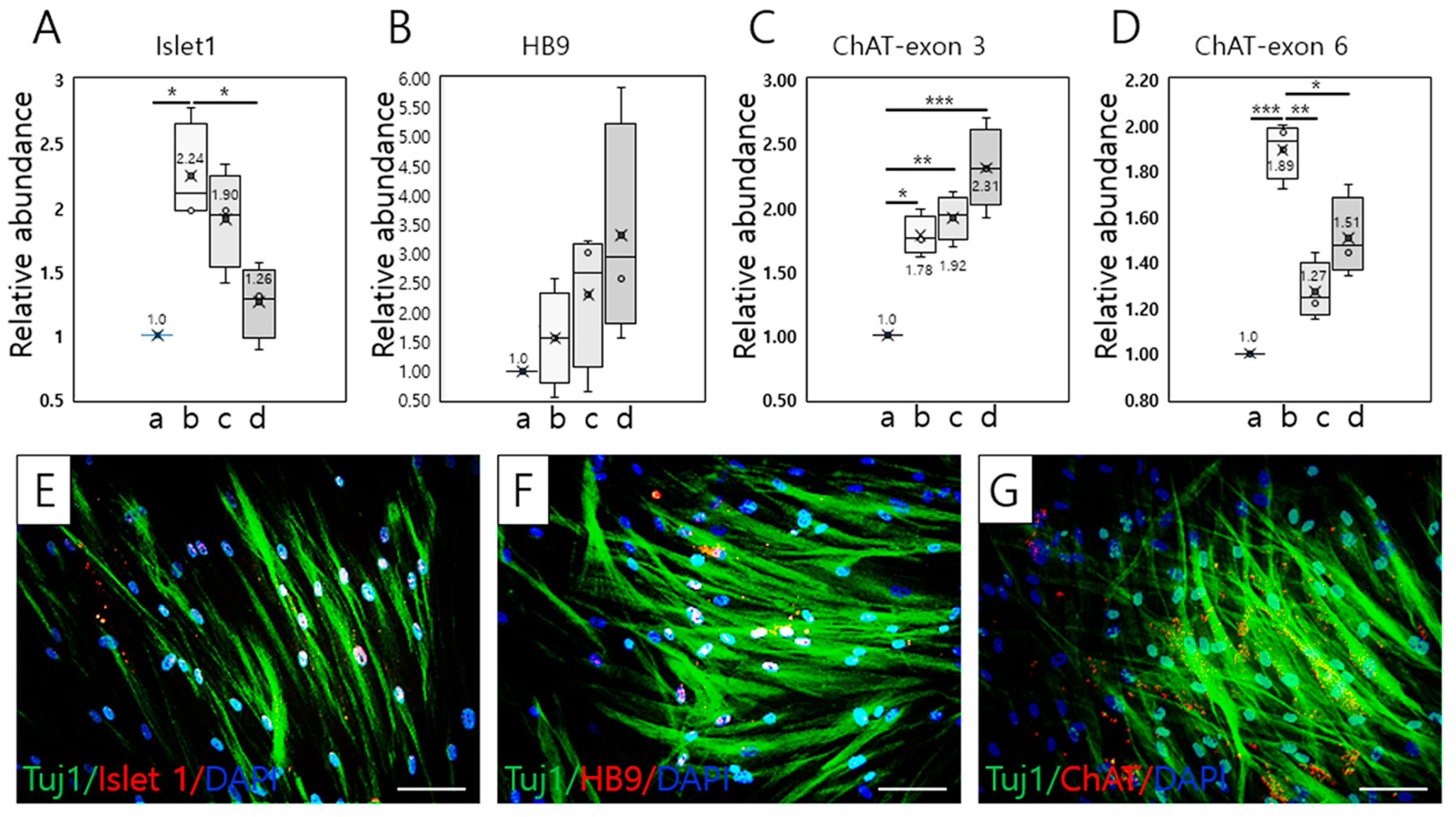Ijms Free Full Text Differentiation Of Motor Neuron Like Cells From Tonsil Derived Mesenchymal Stem Cells And Their Possible Application To Neuromuscular Junction Formation Html Ijms Free Full Text Differentiation Of Motor Neuron Like Cells From Tonsil Derived Mesenchymal Stem Cells And Their Possible Application To Neuromuscular Junction Formation Html