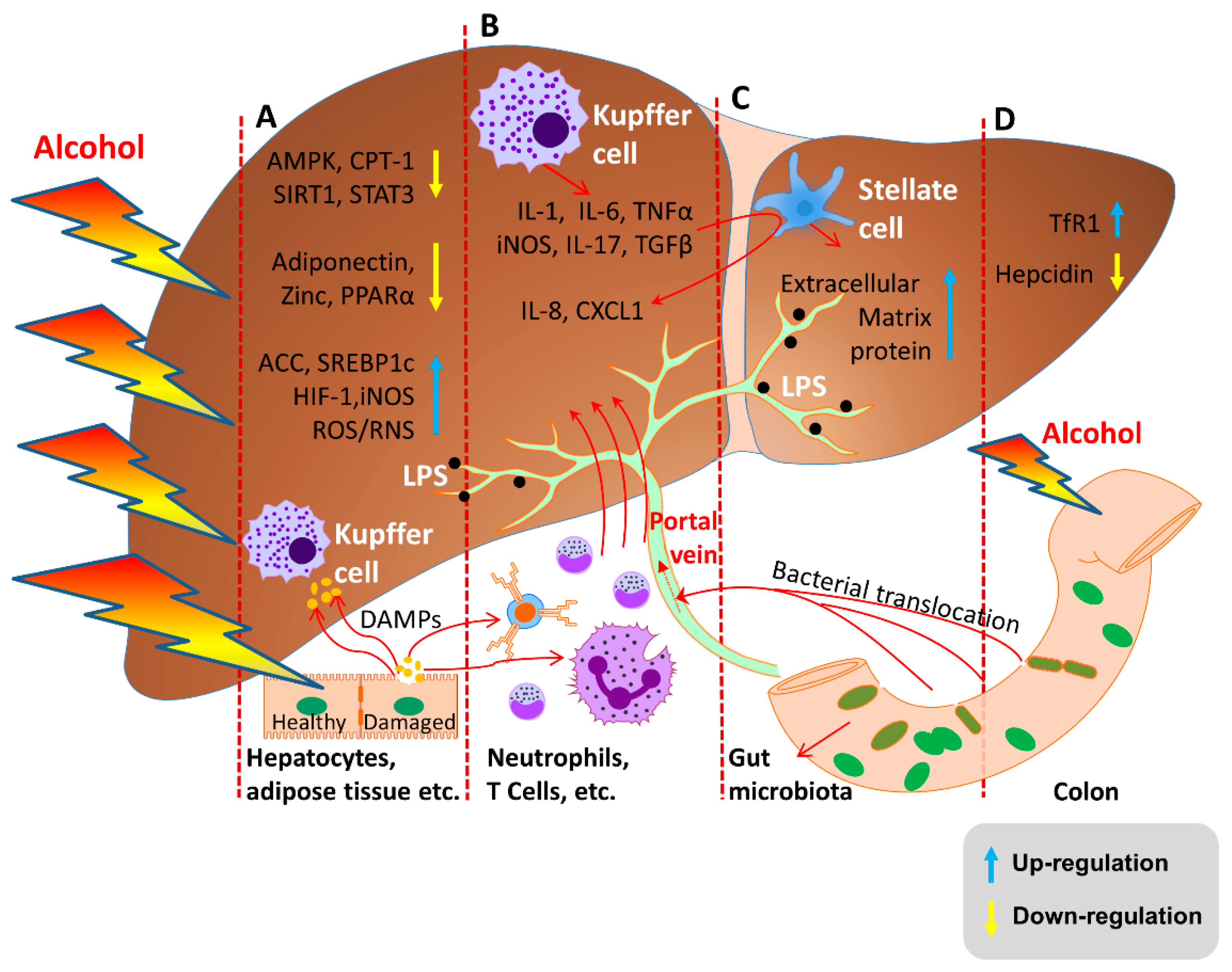 Pathogenesis Of Alcoholic Liver Disease