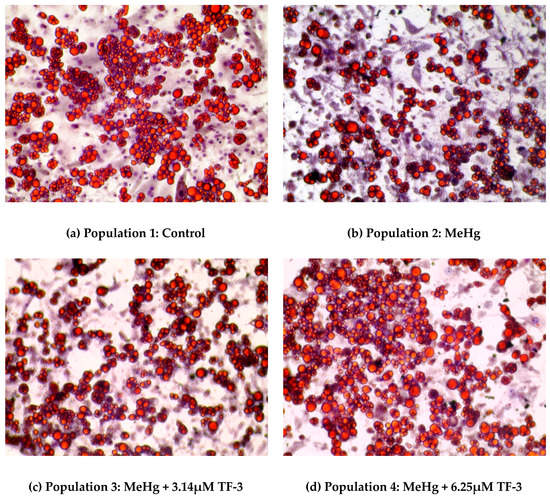 Ijms Free Full Text Effects Of Methylmercury And Theaflavin Digallate On Adipokines In Mature 3t3 L1 Adipocytes Html