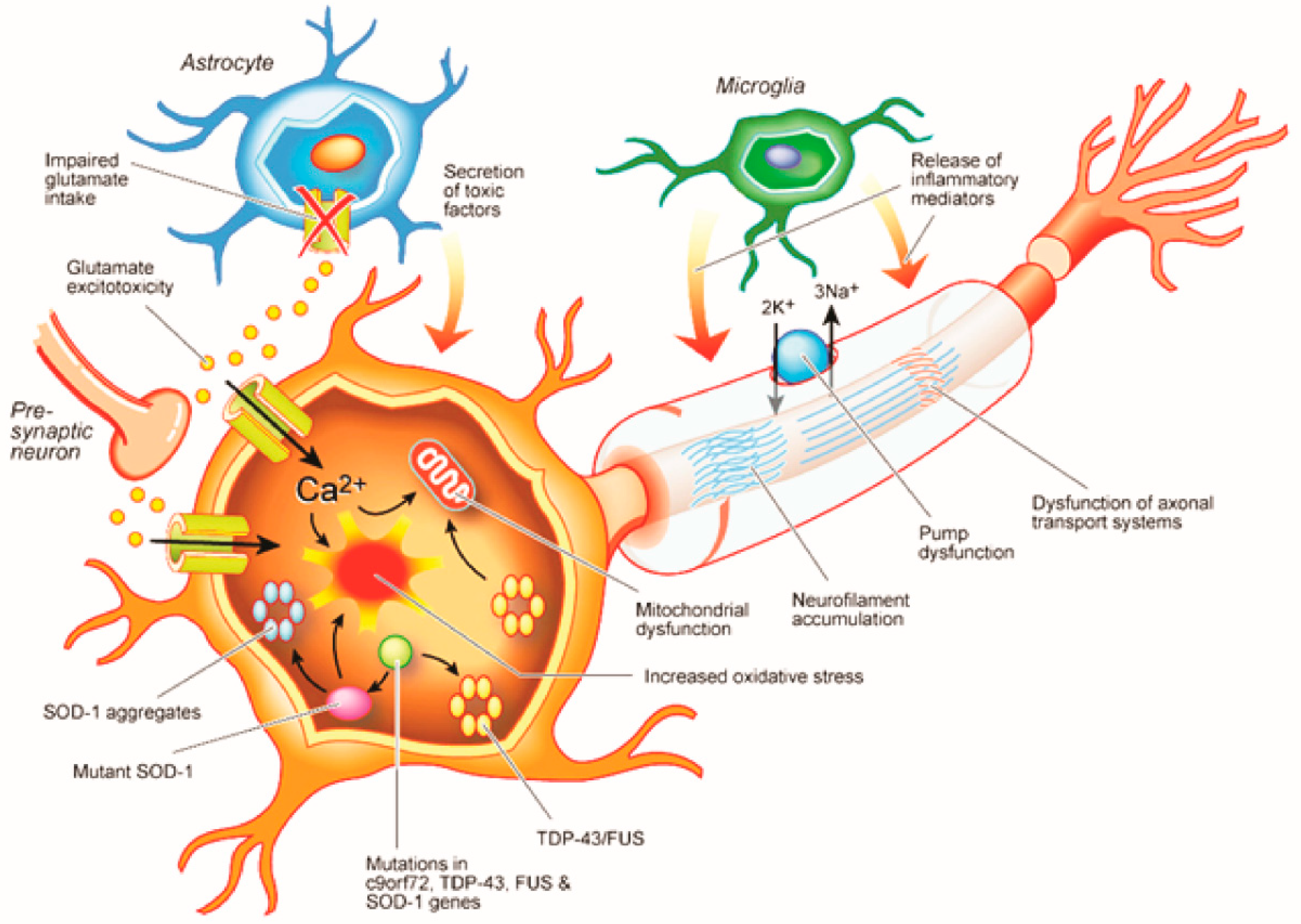 IJMS | Free Full-Text | Pathophysiology and Diagnosis of ...