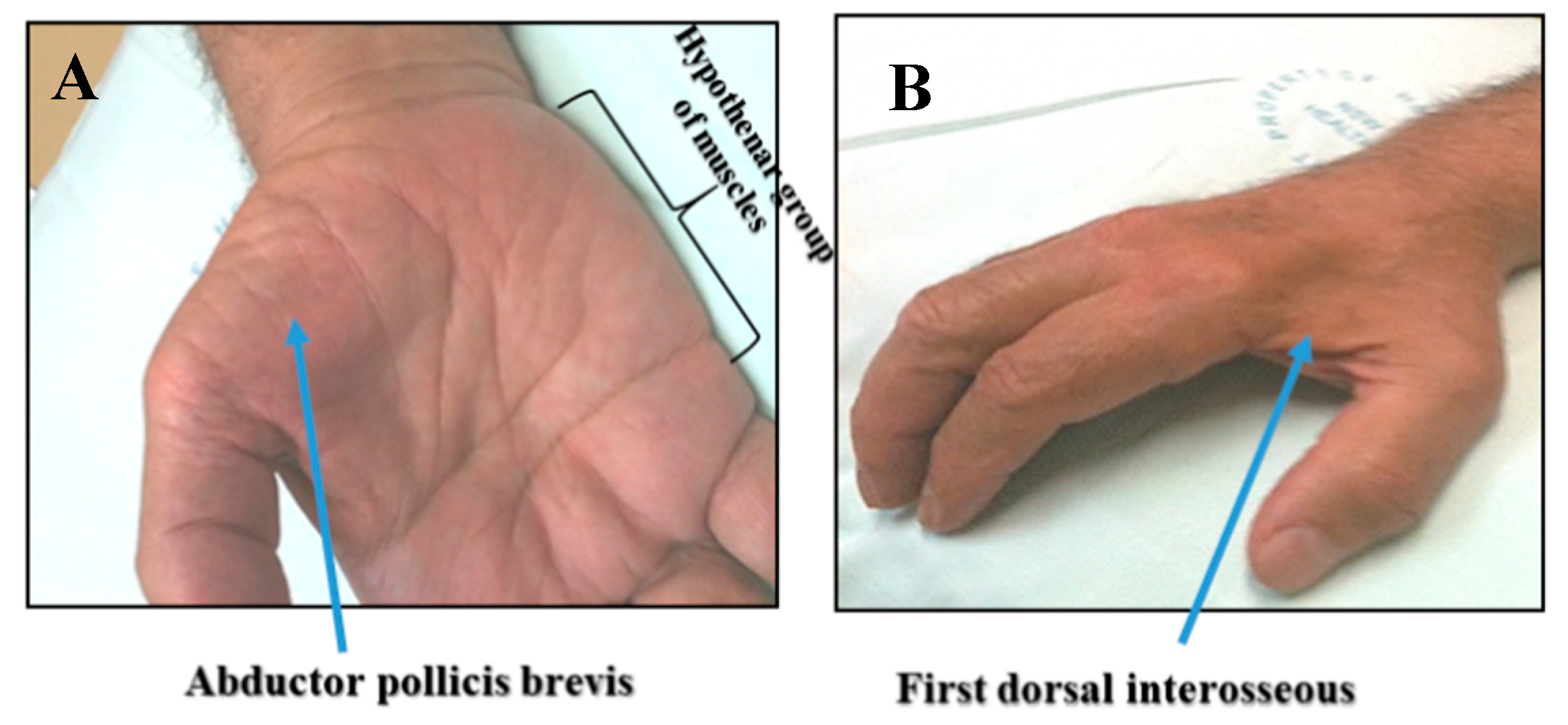 Ijms 20 02818 g003 Ijms 20 02818 g003