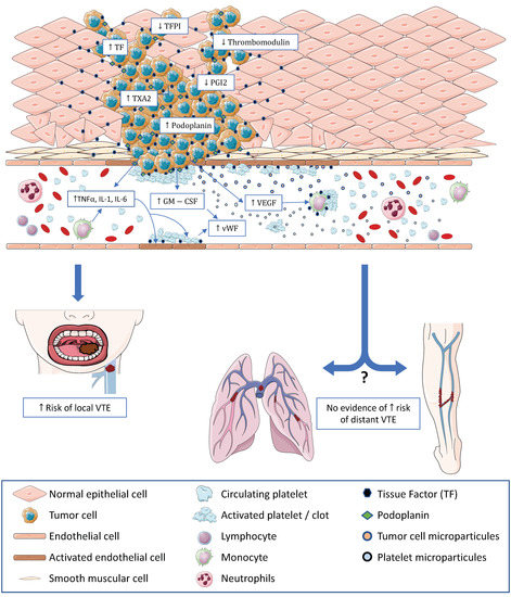 Thrombosis Risk Associated with Head and Neck Cancer: A Review