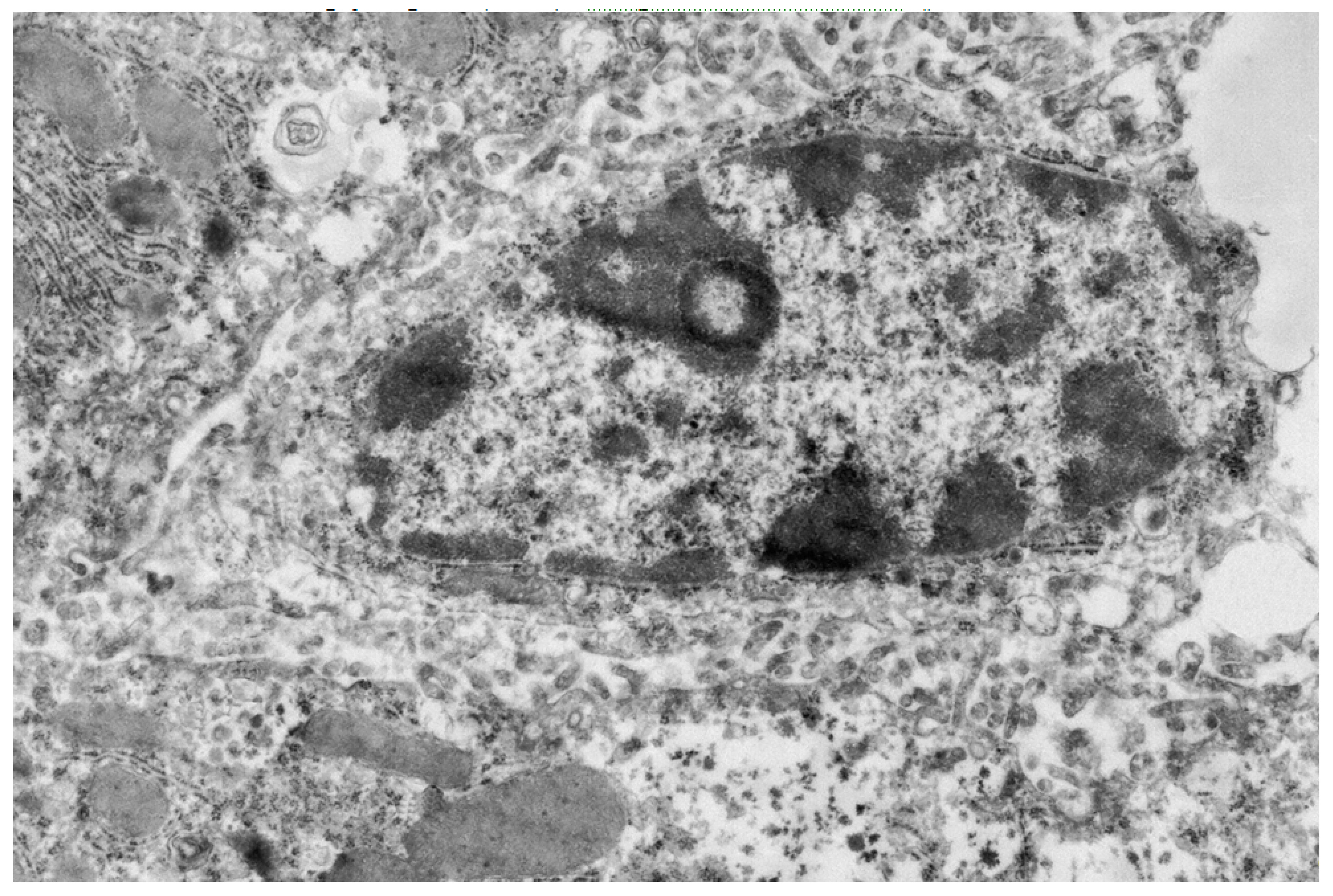 Ijms 20 03189 g002 Ijms 20 03189 g002