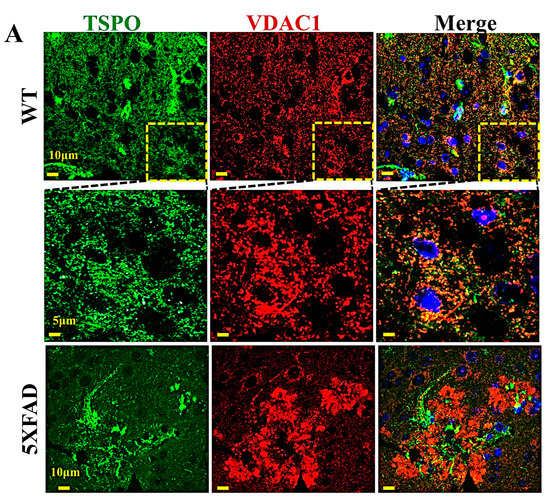 VDAC1 and the TSPO: Expression, Interactions, and Associated VDAC1 and the TSPO: Expression, Interactions, and Associated