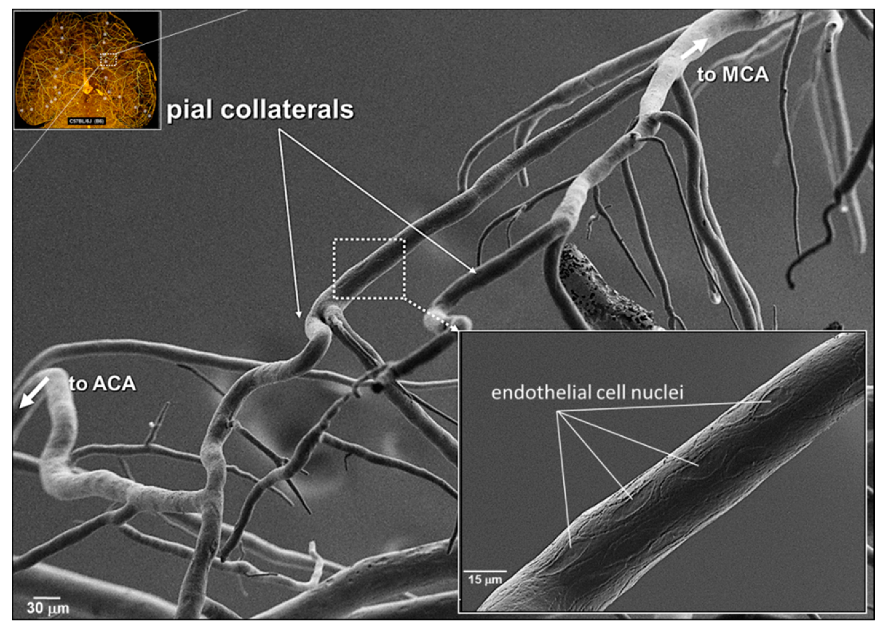 snatch Patent Diskret IJMS | Free Full-Text | Collateral Vessels Have Unique Endothelial and  Smooth Muscle Cell Phenotypes | HTML