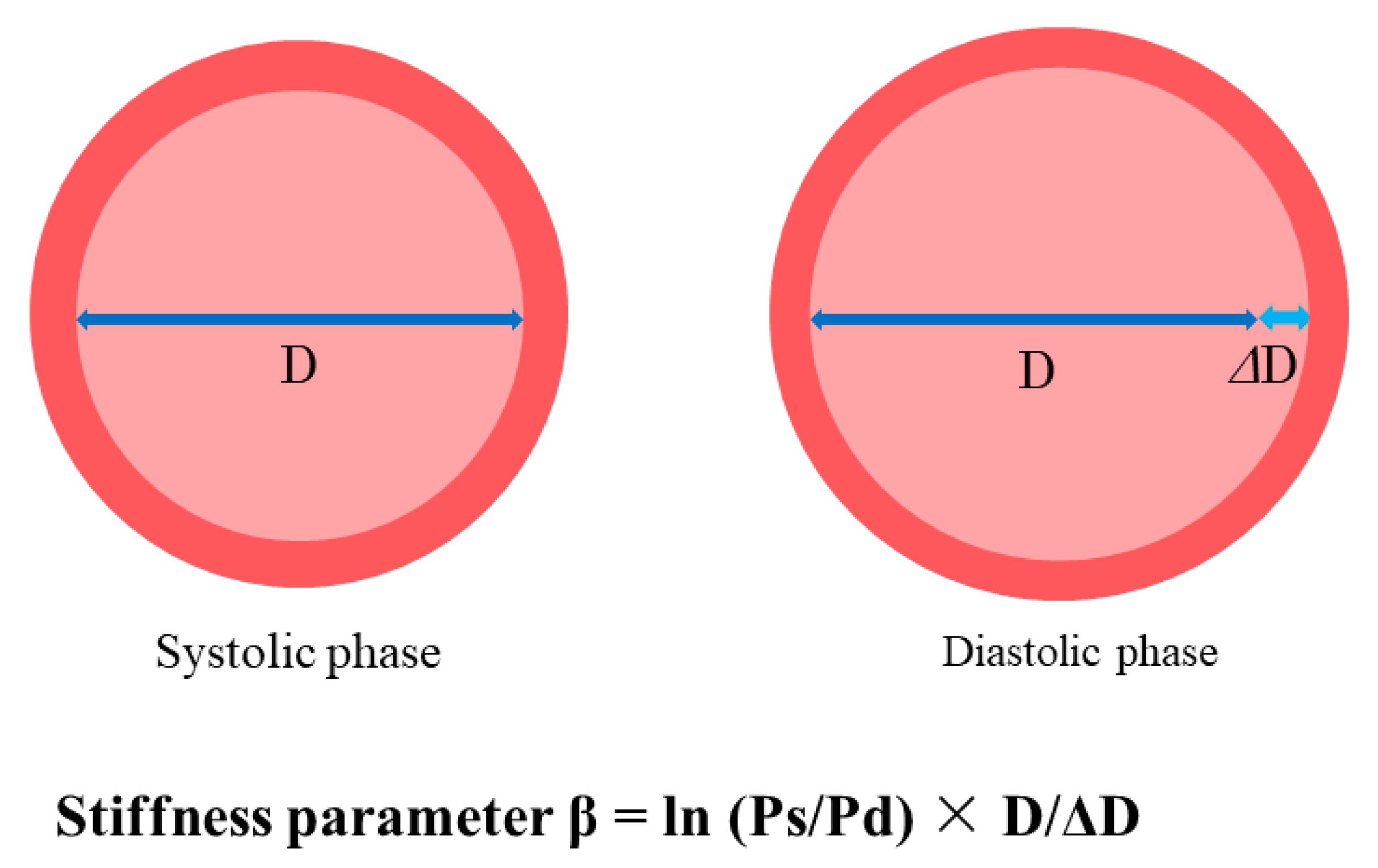 Index am. Radial stiffness. Stiffness. “Bias stiffness of Stents. Direct stiffness method temperature.