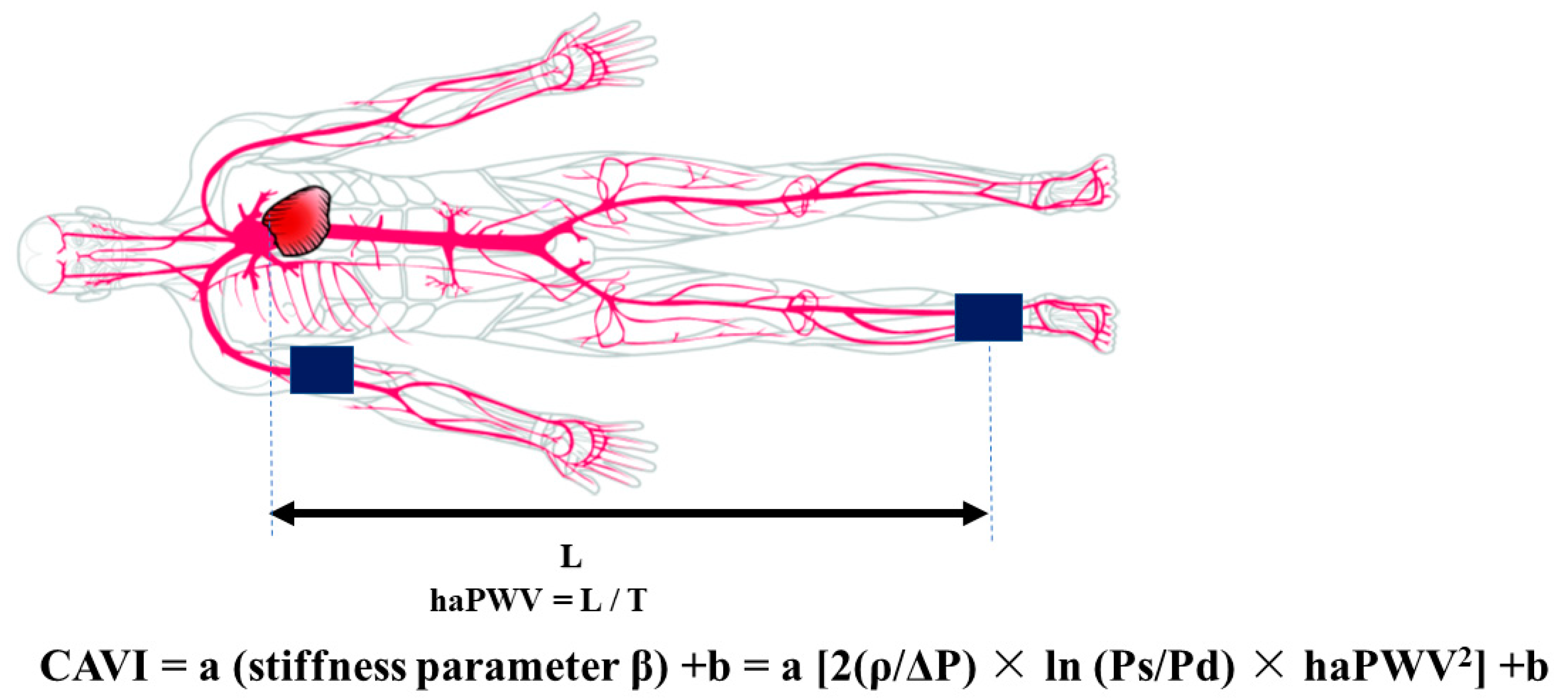 Prognostic Value of Cardio-Ankle Vascular Index for