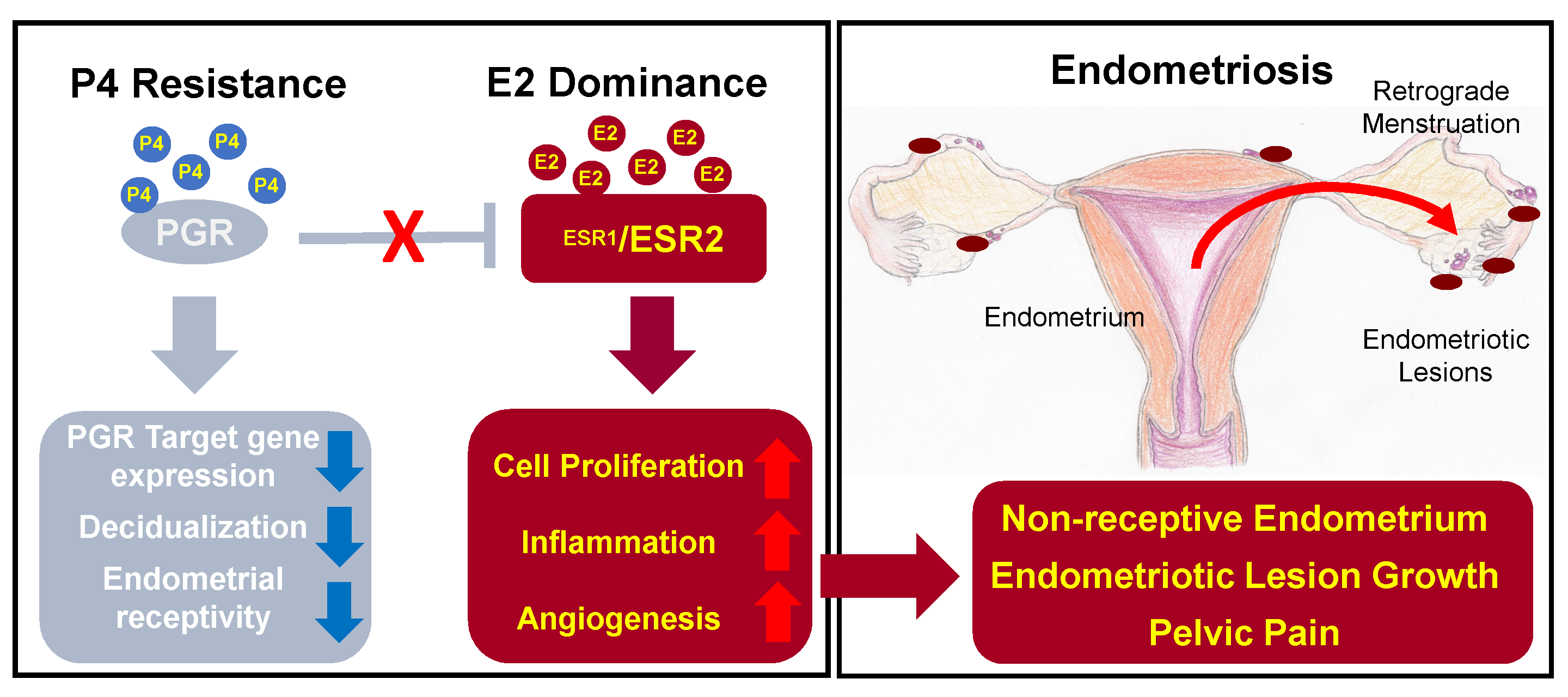 Endometriosis tratamiento hormonal