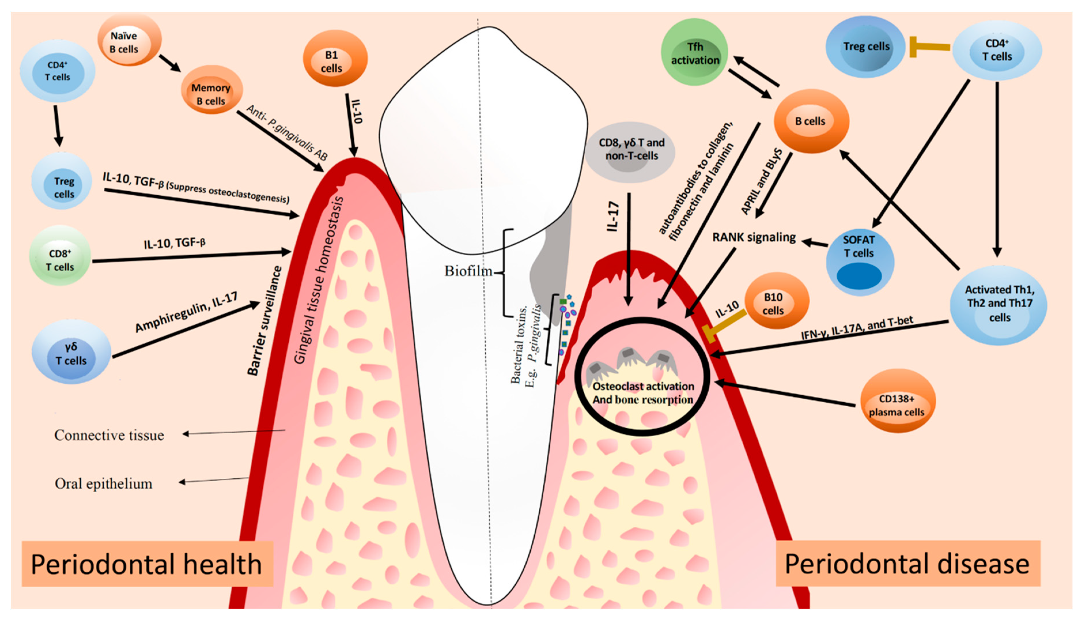 IJMS Free FullText T and B Cells in Periodontal Disease New