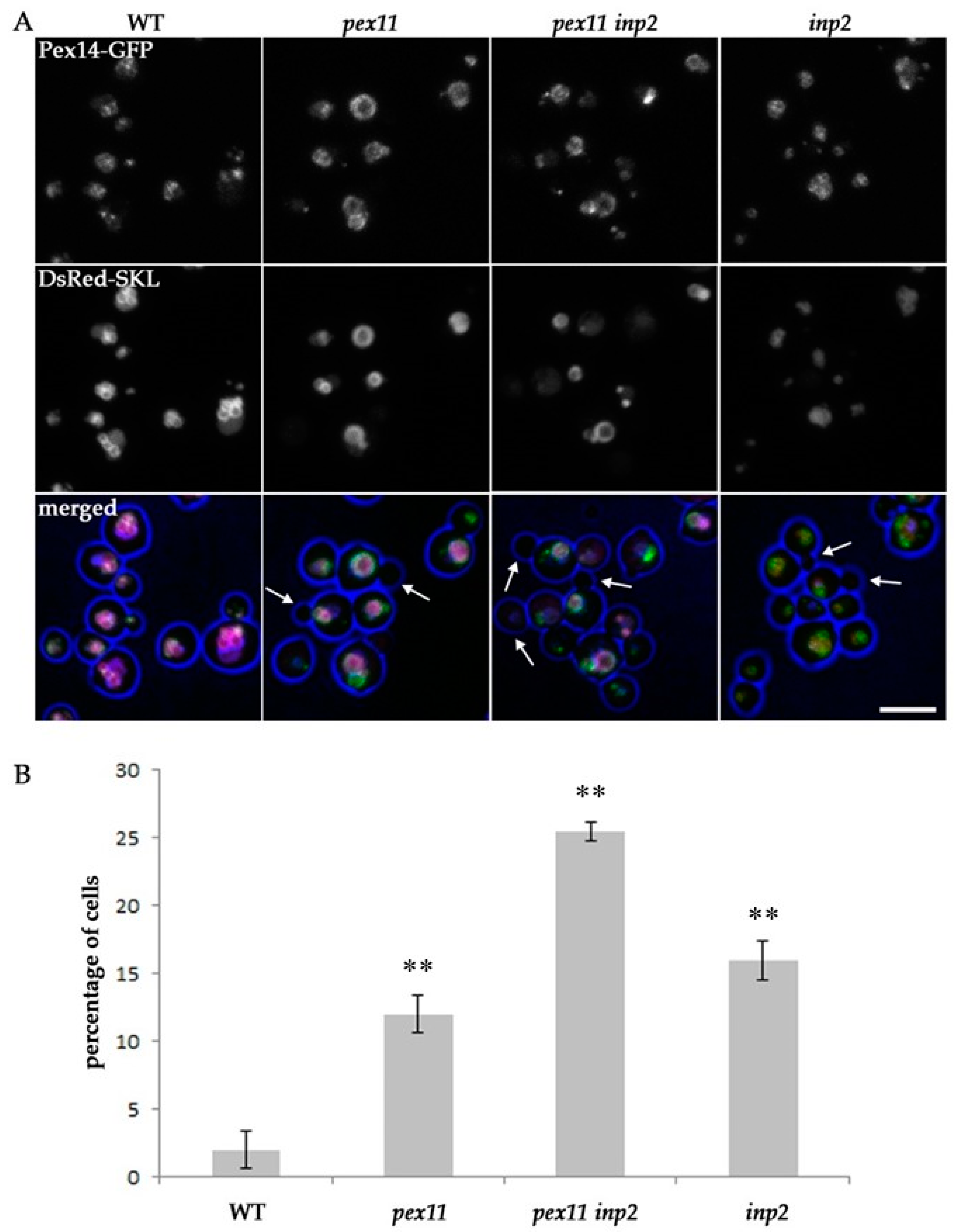 IJMS | Free Full-Text | Peroxisome Maintenance Depends on De Novo