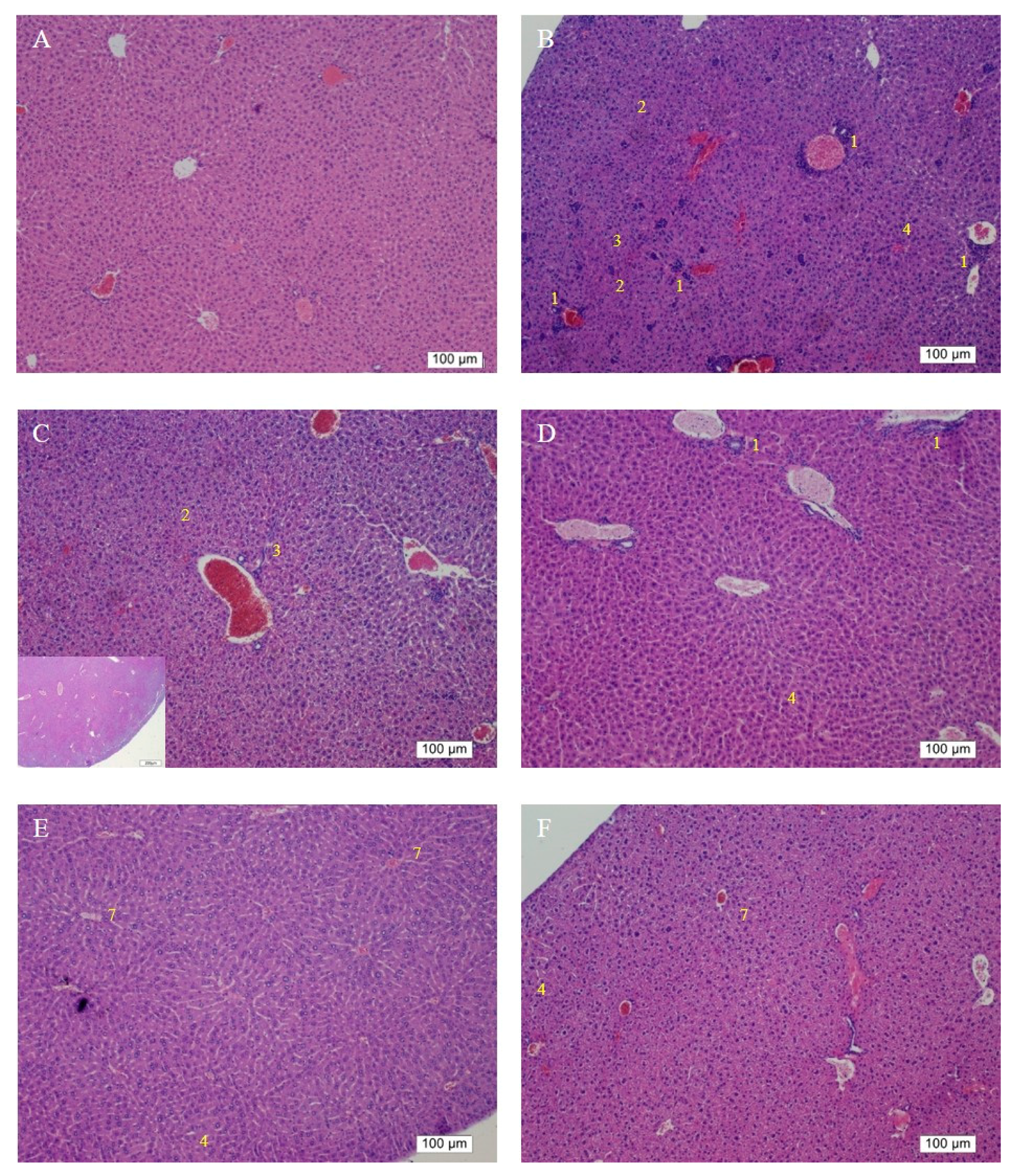 Ijms 20 04057 g006a